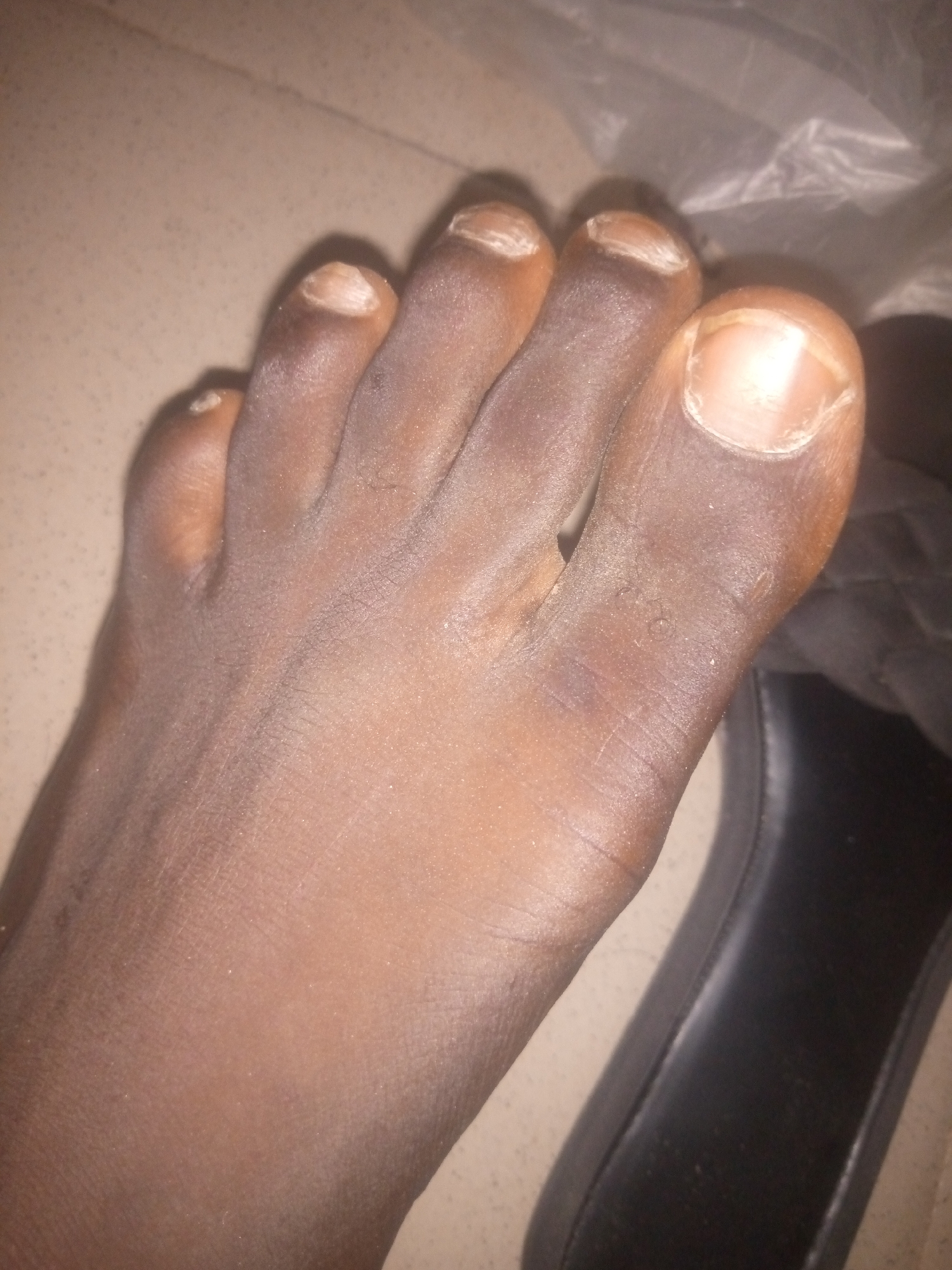 The image shows a close-up view of a left foot with dark skin. The foot is resting on a light-colored tiled surface, with a black object, possibly a shoe or sandal, partially visible to the right. The toenails are visible, appearing to be unpolished and somewhat dry. The skin of the foot shows some texture and a slight sheen, possibly from lotion or moisture. The lighting is dim, casting subtle shadows. There are no people visible in the image. The scene is indoors, given the tiled floor and the presence of footwear.