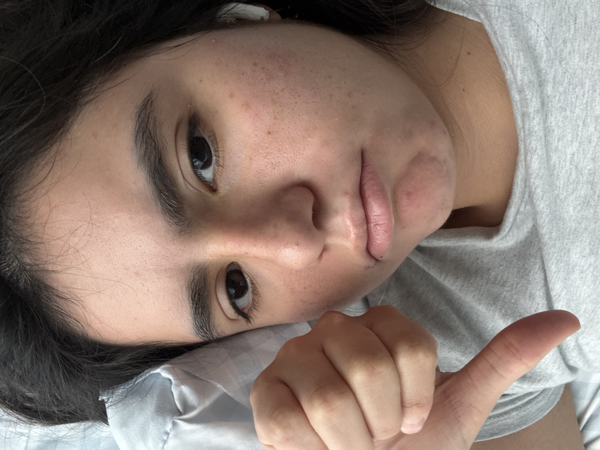 The image shows a close-up portrait of a person, likely female, lying down indoors. Her head is resting on a light-colored pillow or fabric, and her dark hair is visible around her head and shoulders. She is wearing a light gray t-shirt. A white earbud is partially visible in her left ear.
The person is looking directly at the camera with dark eyes and natural, thick eyebrows. Her facial expression is somewhat neutral or slightly pensive, with her lips slightly parted and appearing natural, showing some texture and a small dark mark near the corner of her lower lip on the right side. Her skin tone is light to medium, with visible freckles and natural skin texture across her forehead, cheeks, and nose.
In the foreground, her right hand is raised, making a thumbs-up gesture. The lighting is soft and even, suggesting an indoor setting, possibly during the daytime without direct sunlight. There are no specific location cues beyond it being indoors. No text is visible in the image.