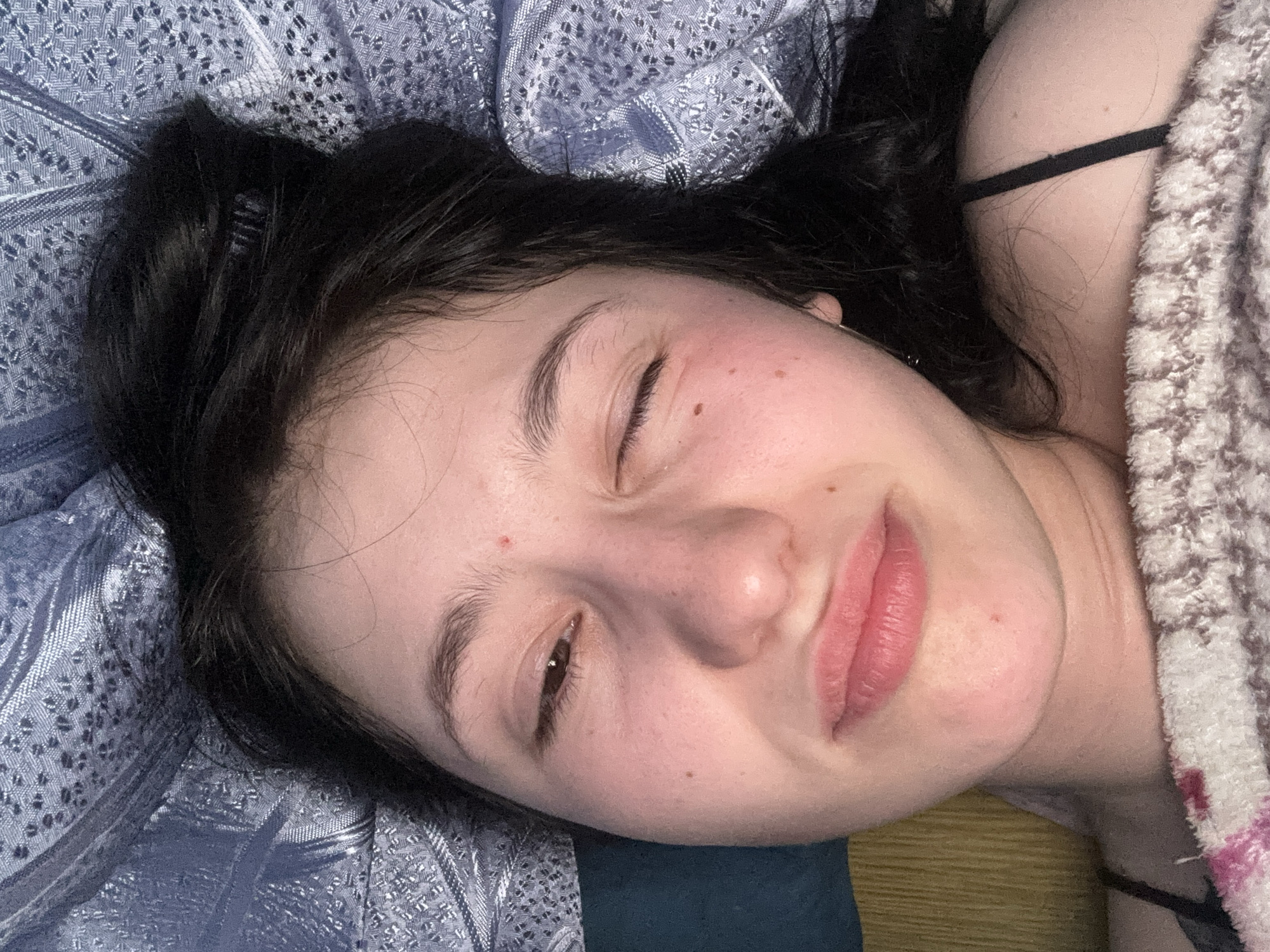 A young woman with dark hair, a few visible blemishes on her face, and one eye partially closed is lying on a bed with a blue patterned sheet. A textured blanket is visible on the right side of the frame. A thin, black strap is visible near her shoulder. There is no indication that this image has a connection to the city of Фоки, Russia.