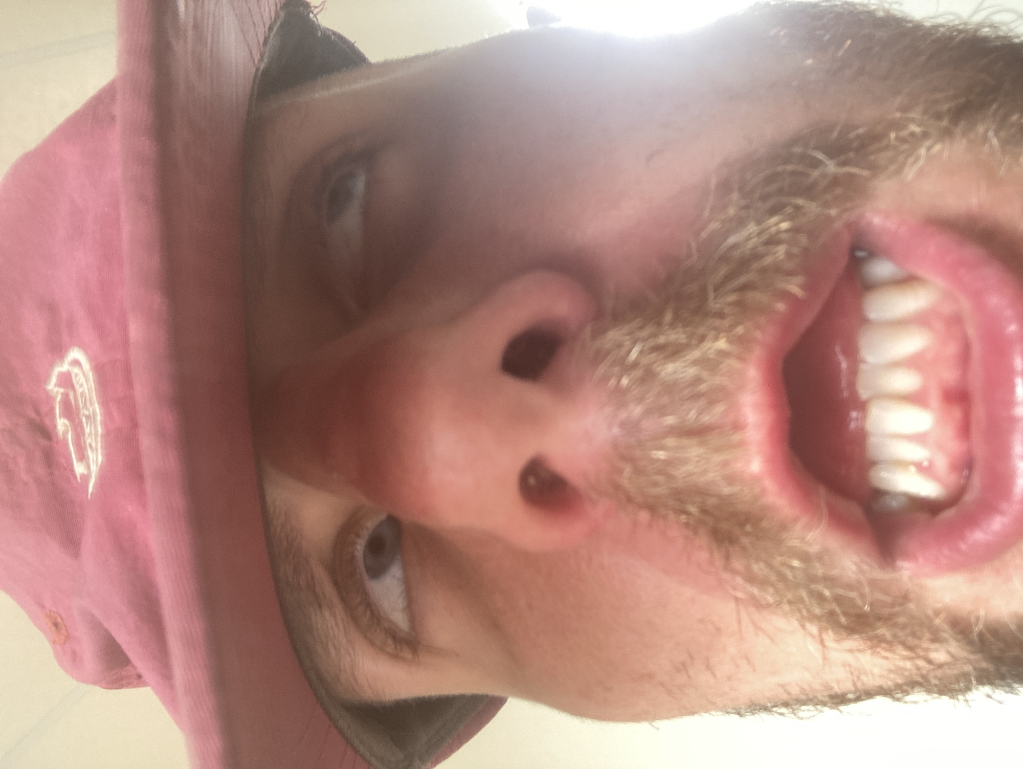 An extreme close-up selfie of a light-skinned person with a stubble beard and wearing a maroon cap. The person is looking upwards with an open mouth, exposing their teeth. No location information is available.