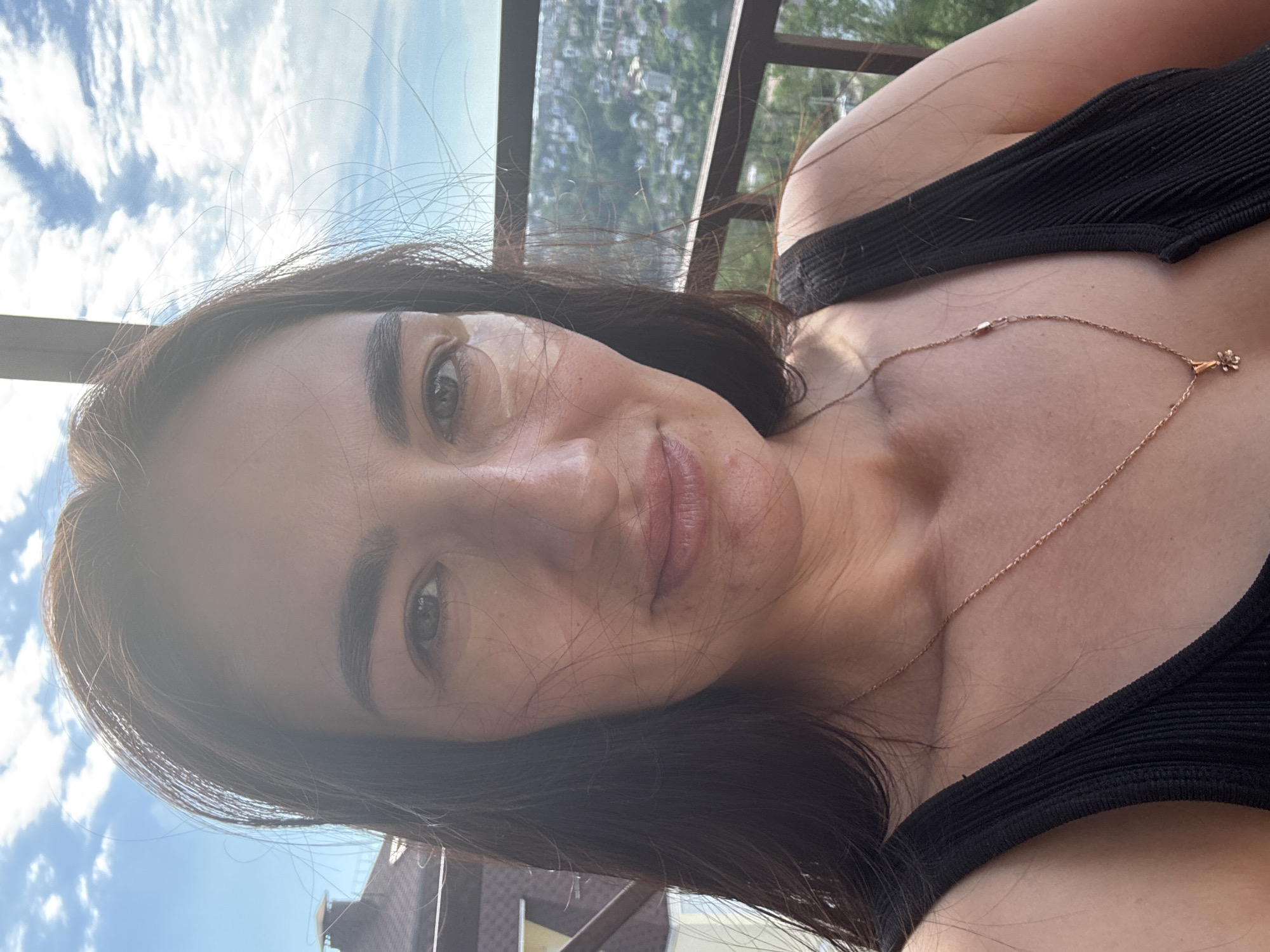 A medium shot depicts a woman outdoors in Sochi, Russia, evident from the urban landscape visible in the background. She is wearing a black tank top and a delicate gold necklace with a floral pendant. A small, circular bandage is visible on her left cheek, under her eye. The background reveals a city with dense vegetation and structures on a hillside, under a sky with light clouds. The woman is near a metal railing or structure, likely a balcony or elevated platform. The image appears to be taken with a slightly upward angle, possibly a selfie.