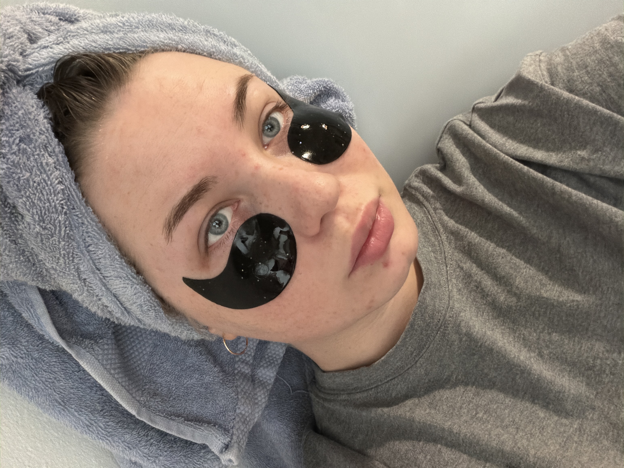 A young fair-skinned woman is depicted at a close-up angle, seemingly indoors. She wears a gray t-shirt and a light blue towel is wrapped around her head. Two black, semi-circular eye patches with sparkly, confetti-like inclusions cover the under-eye area. The woman has light-colored eyes and appears to have no makeup other than what may be lip gloss. She has some blemishes on her face. She is wearing a single hoop earring. There is no evidence to confirm this photo was taken in the city of Chaikovsky, Russia, and should not be assumed.