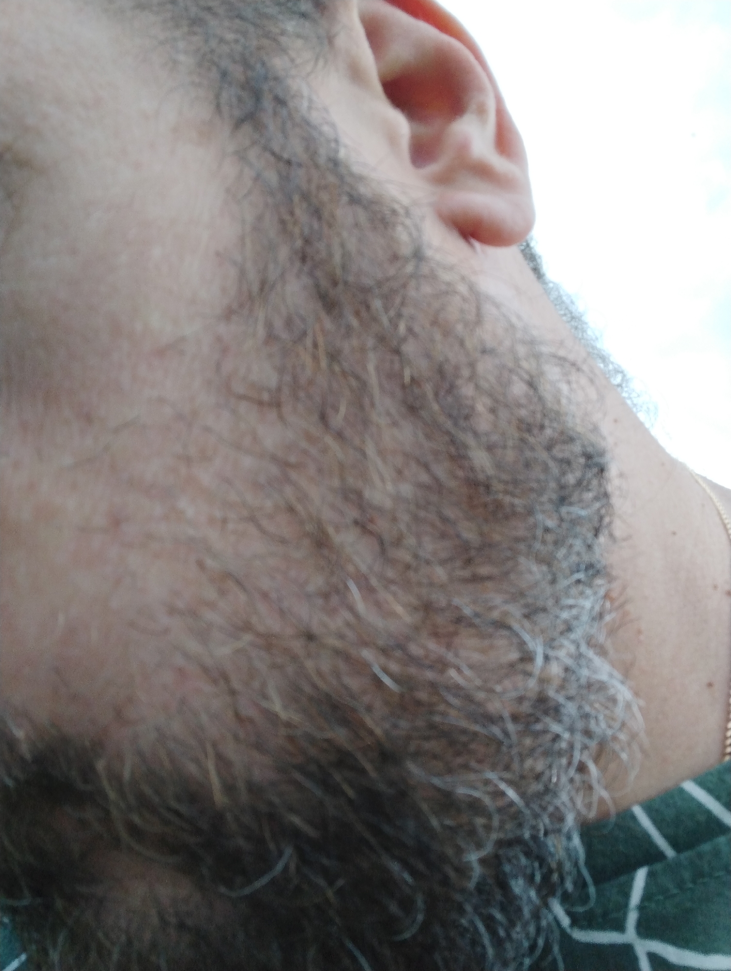 The image shows a close-up, low-angle view of a person's face, focusing on their cheek, beard, and ear. The person has a beard with graying hairs and appears to be looking upwards. The background is out of focus, showing a bright sky and a hint of a green and white striped garment. The location is identified as the city of Ширяево (ильинский), Russia, though this context does not appear to be directly depicted in the image itself.