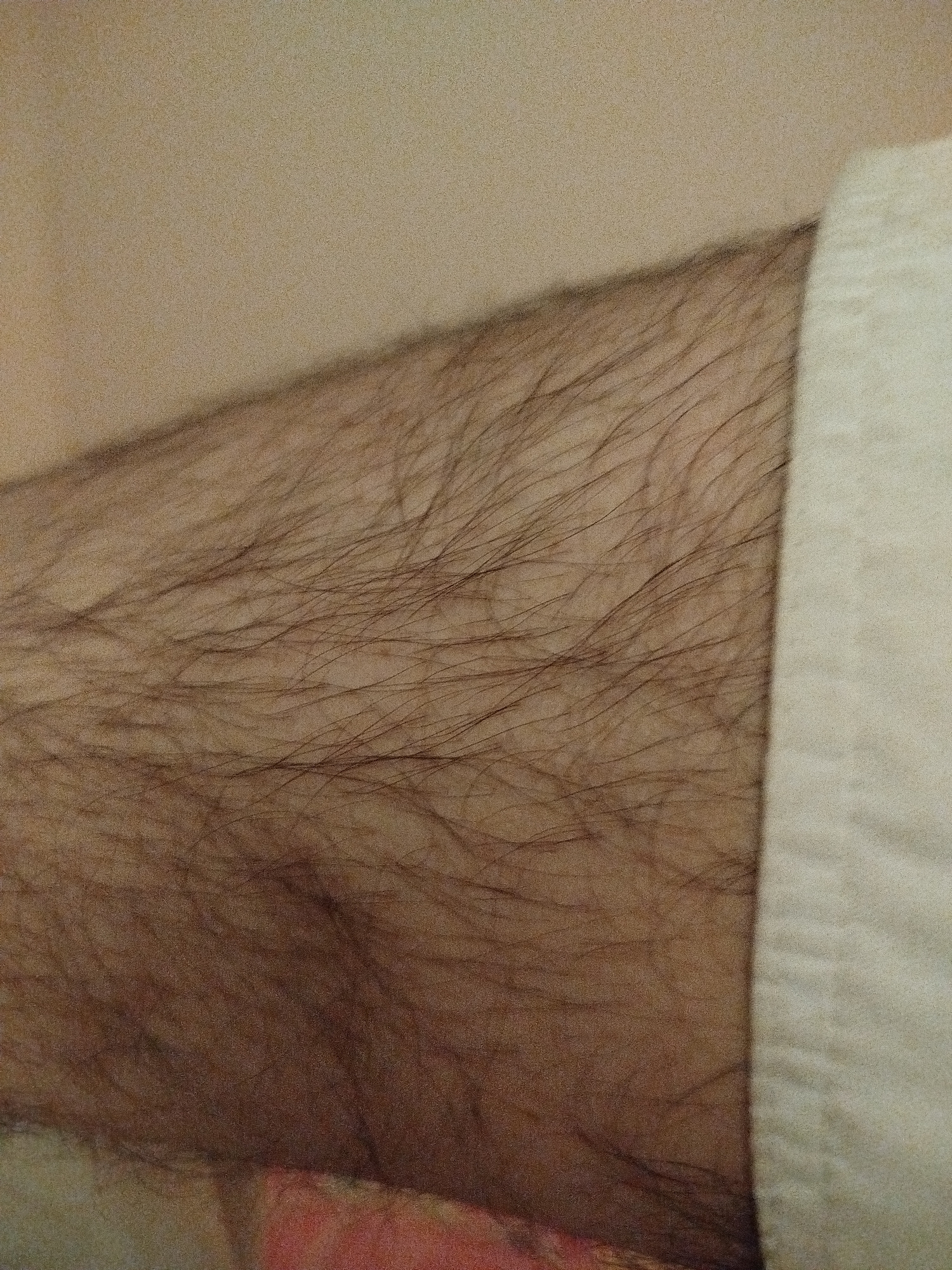 The image shows a close-up view of a person's forearm, covered in fine, dark hair. The skin is a light tan color. To the right, a white fabric, possibly clothing, is visible. The lighting suggests an indoor setting, with shadows cast on the skin by the hair and the fabric. The image does not provide any information about the location in Lassan, Pakistan, or any specific details about people, actions, or interactions.