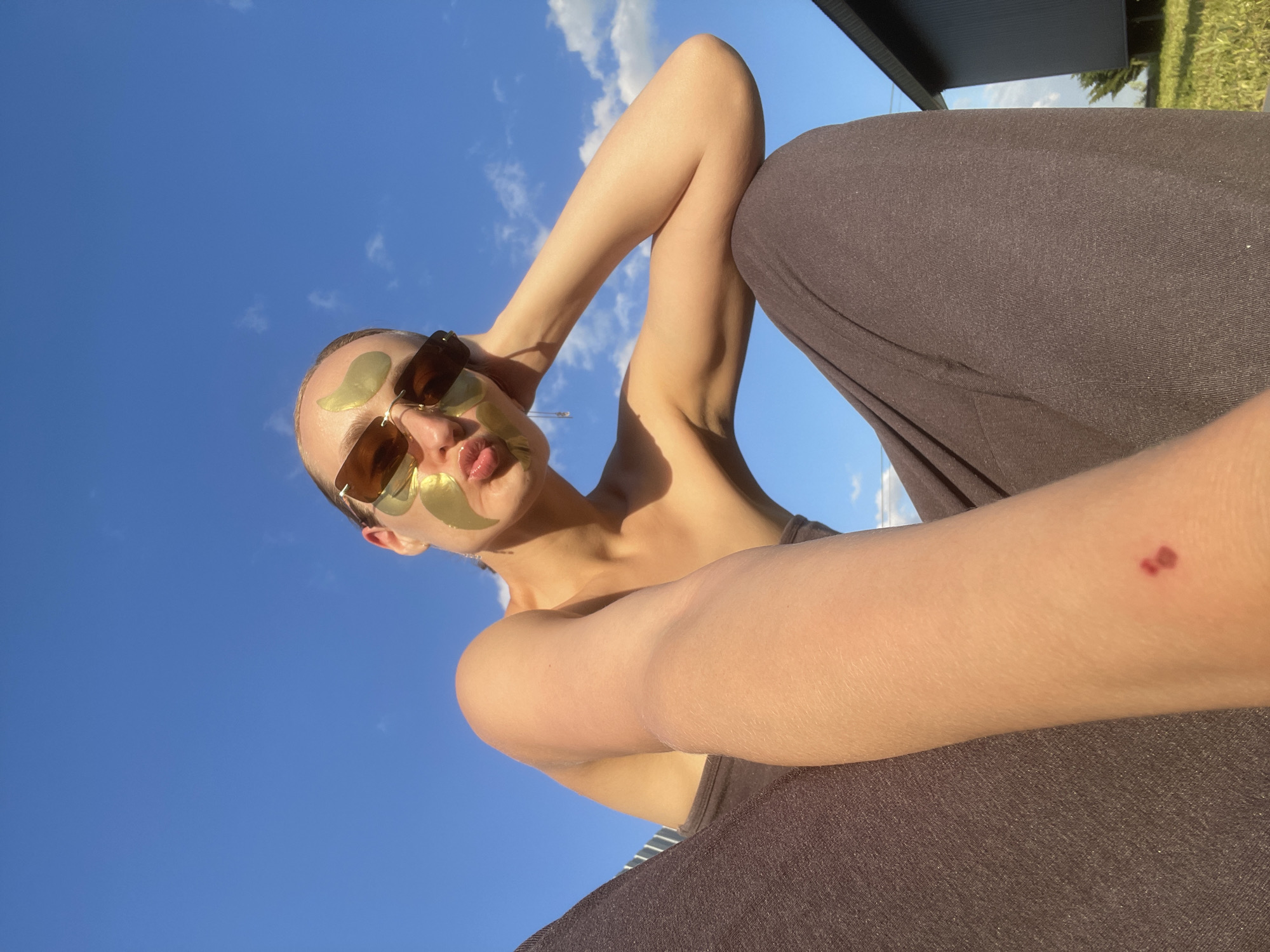 A low-angle shot of a person, presumably female, with light skin, wearing sunglasses and gold-colored facial patches on their forehead and around their mouth. They have their arms raised behind their head and are wearing a dark-colored top and pants. A small, dark mark or bruise is visible on their forearm. The background consists of a bright blue sky with scattered white clouds. The upper right corner of the image shows a dark roofline and some greenery. Location: likely outdoors in Подшивалово, Russia.