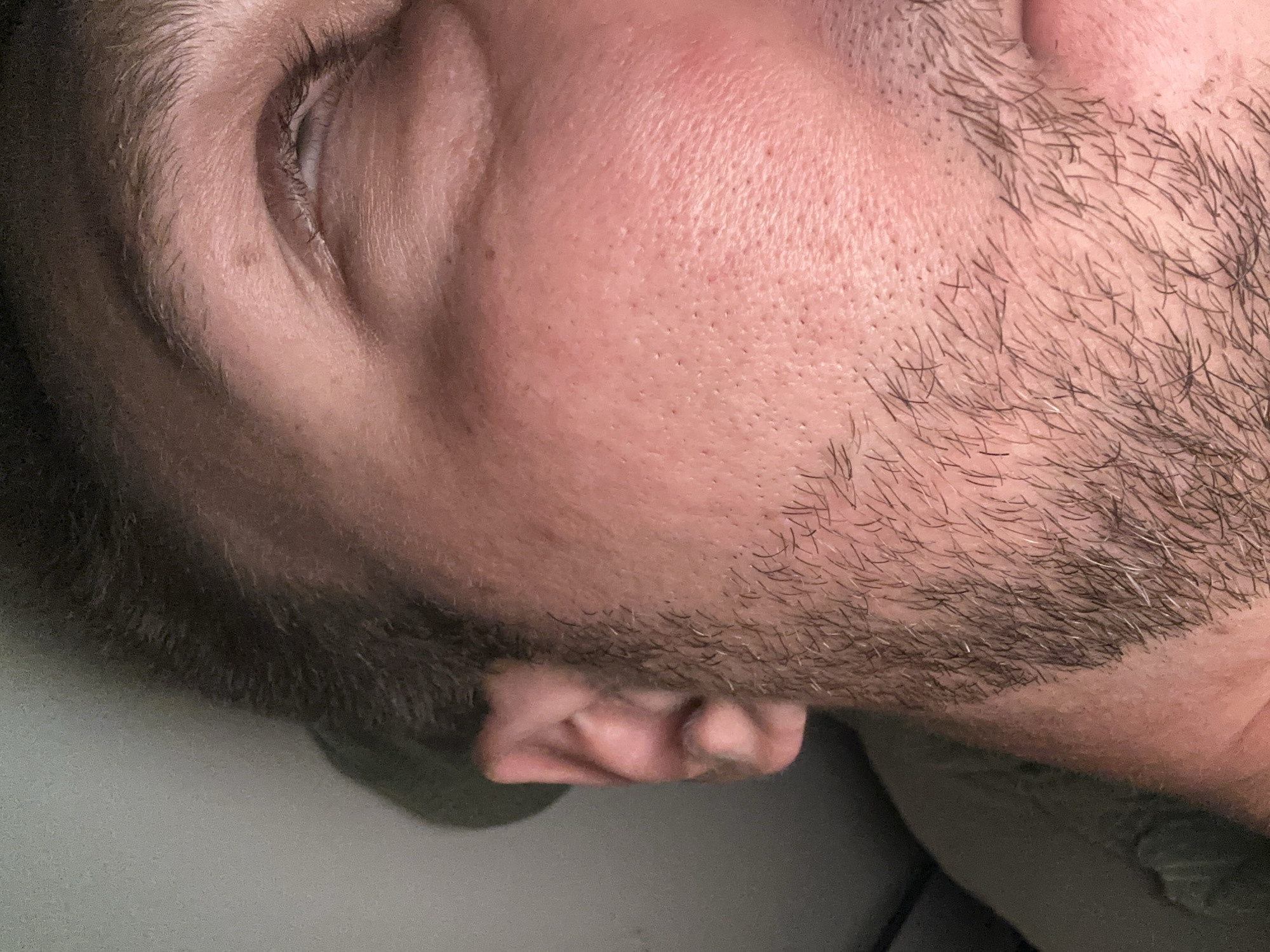 The image is a close-up, angled shot of a person's face, focusing on the right eye, cheek, and ear. The person appears to have light skin with visible pores and some redness on the cheek. They have a light stubble beard. The right eye is closed, with eyelashes and eyebrows visible. The ear is partially visible on the left side of the frame. The background is out of focus and appears to be a muted gray or beige, possibly an indoor environment. There are no recognizable landmarks or indications of the specific location within Zvezdara Urban Municipality, Serbia, or any other city.