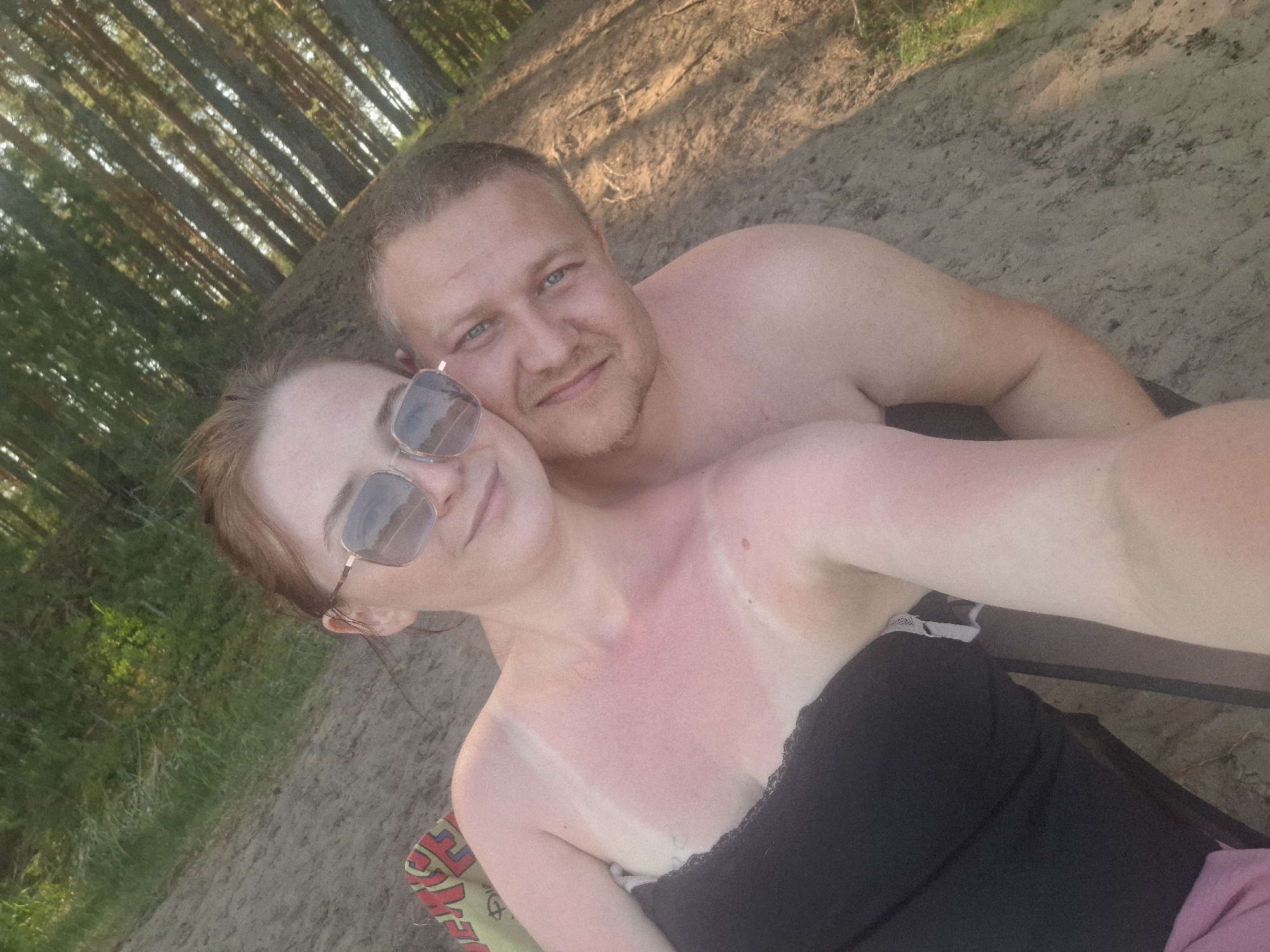 A selfie shows a shirtless man and a woman wearing a black top and sunglasses, sitting outdoors in Chaikovsky, Russia. The woman's chest and shoulders are sunburned. Behind them are trees and sandy ground.