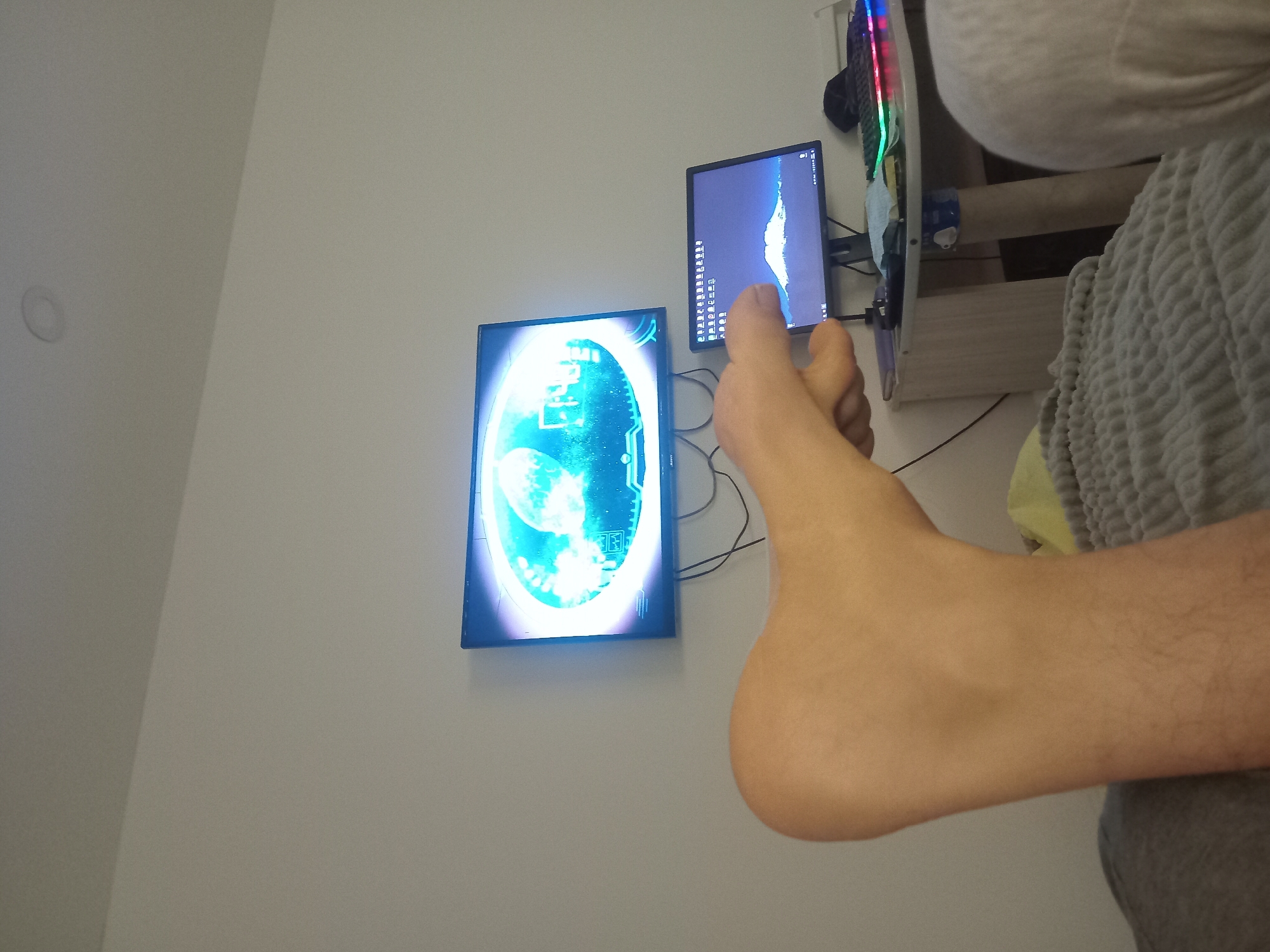 The scene is an interior shot with a predominantly white wall in the background. Two computer monitors are mounted on the wall; the left one displays a blue and white graphic, and the right one shows a blue and black interface. Computer equipment, including a keyboard with colored lights, is visible behind the monitors. In the foreground, a person's leg and foot are prominently displayed. The person is wearing grey clothing, and a textured grey blanket is visible. The location is likely a private residence or office, as the scene depicts personal computer equipment. There is no indication of the location being Batumi, Georgia.