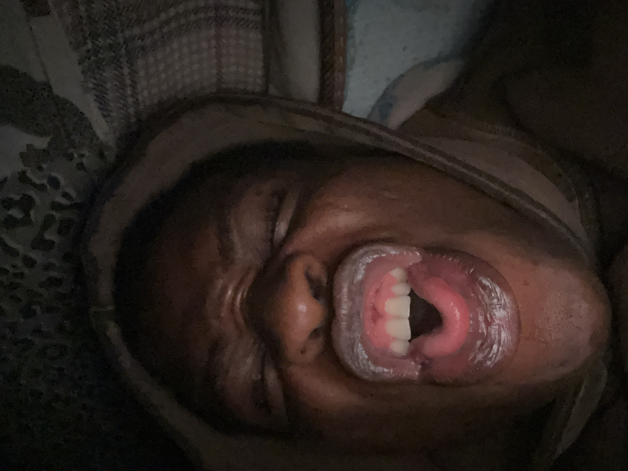A close-up, dimly lit photograph depicts a person lying down, possibly in bed, with their mouth open. The person's eyes are closed. The visible teeth appear to be in good condition. The environment includes bedding or blankets with different patterns visible in the background. The location is unknown.
