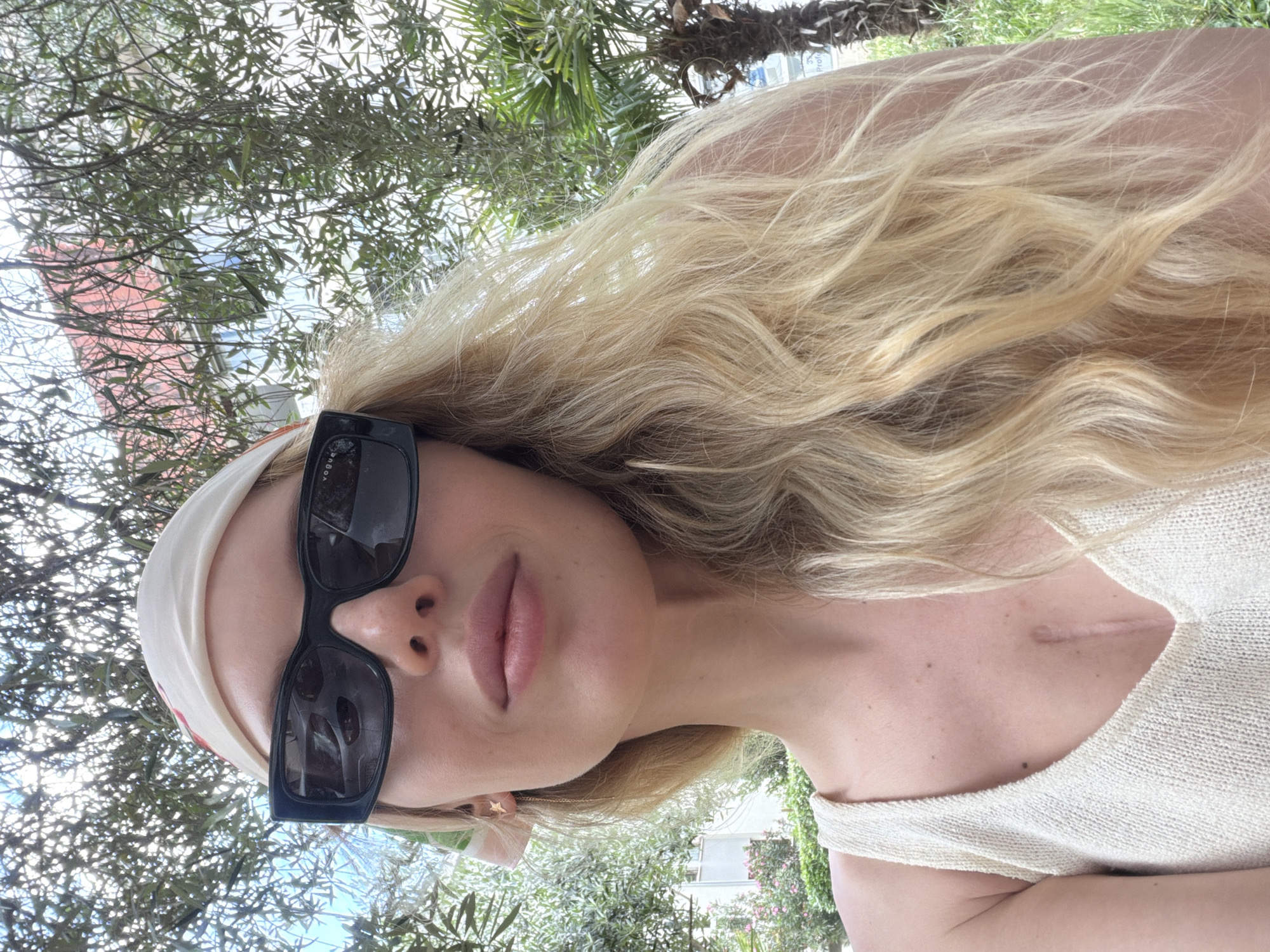 The image shows a woman with blonde, wavy hair and fair skin wearing black sunglasses and a beige headband. She is wearing a light-colored, knitted top with a cutout. A noticeable scar is visible on her upper chest. She appears to be outside, with trees and foliage visible in the background.
The presence of Mediterranean vegetation suggests that the photo was taken in a coastal area. Considering the prompt mentions Budva, Montenegro, the photo was likely taken in a park or outdoor area within the city, possibly near the coast. There is evidence of buildings and houses.