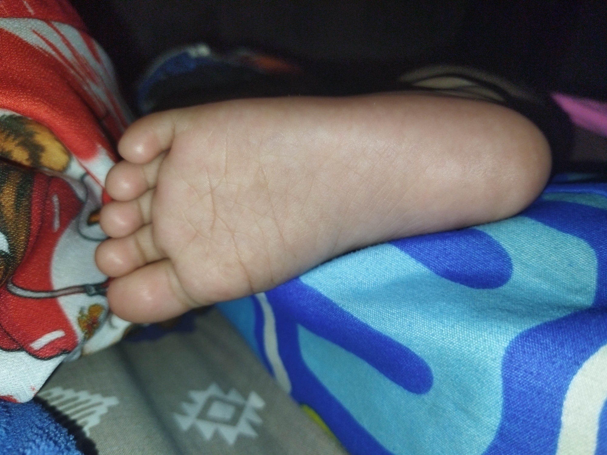 A close-up, high-angle, indoor shot shows a baby's left foot resting on a blue and white patterned fabric. The foot is light-skinned, with visible creases and toes. To the left of the foot, a red, white, and yellow patterned fabric is partially visible. The background is dark and out of focus. The image was taken at an undisclosed location within the city of Suci, Indonesia.