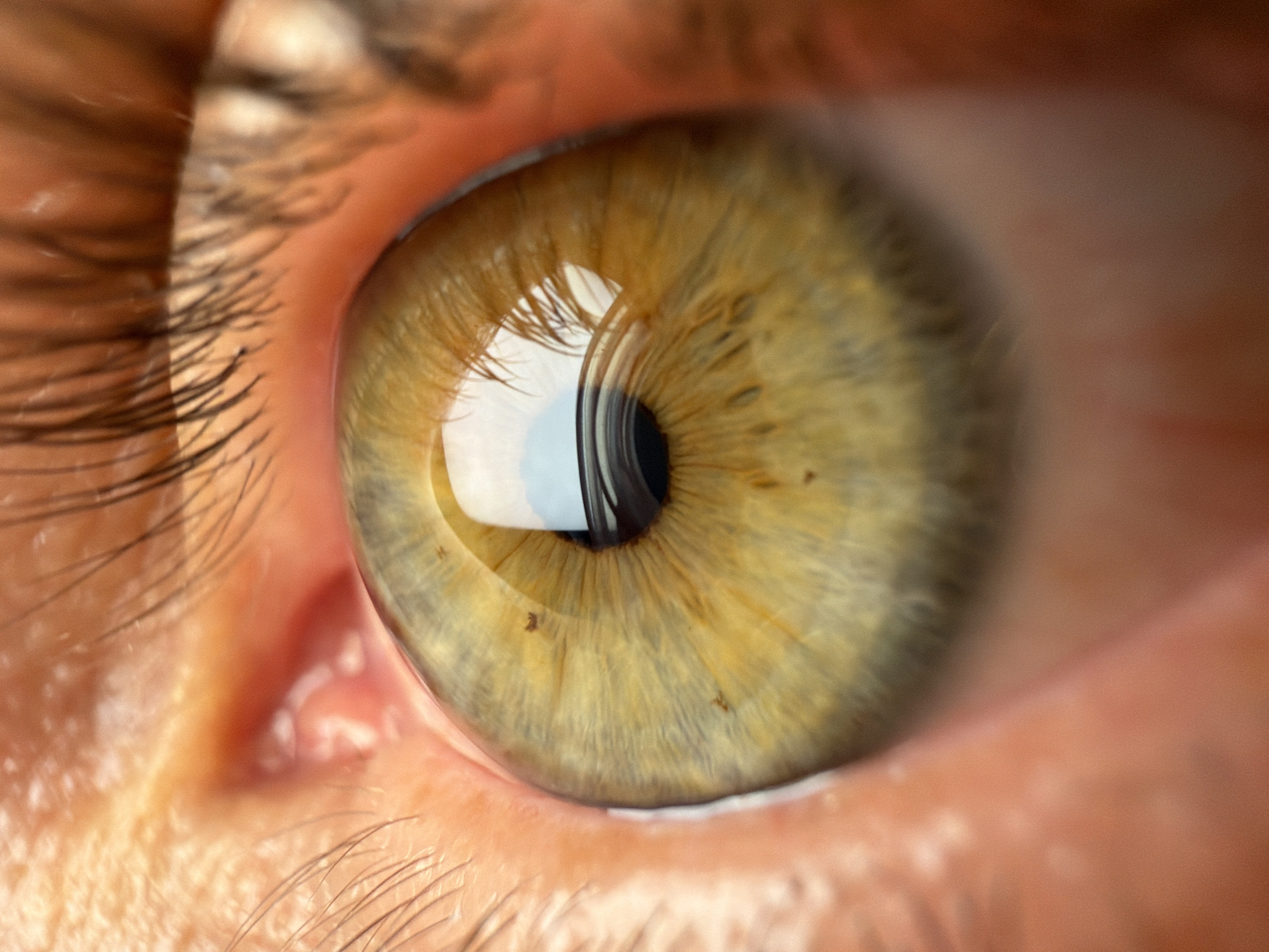 A close-up photograph depicts a human eye with a hazel iris. The pupil is black and reflects light. Eyelashes frame the top and bottom of the eye. The surrounding skin is visible. The photo provides no information about location.