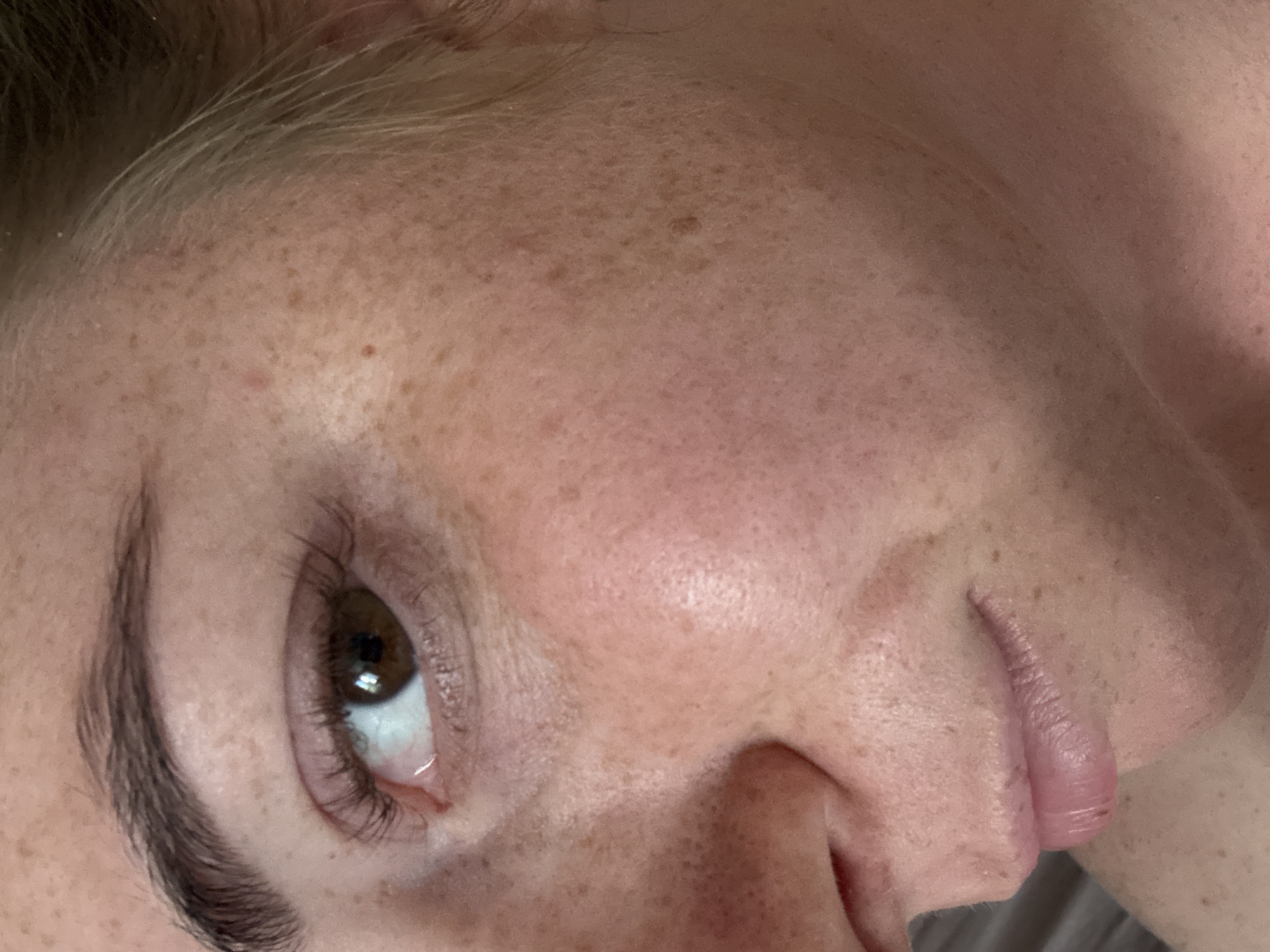 The image is a close-up, rotated view of a person's face. The subject's skin is visible with numerous freckles and some redness. The eye on the left is in focus, showing a brown iris and dark eyelashes. The eyebrow above the eye is also dark and well-defined. The person's lips are in the lower right portion of the image, with a slightly glossy appearance. The background is out of focus and appears to be a textured surface, possibly fabric. The lighting suggests an indoor setting, and there are no external environmental cues. No text is visible in the image.