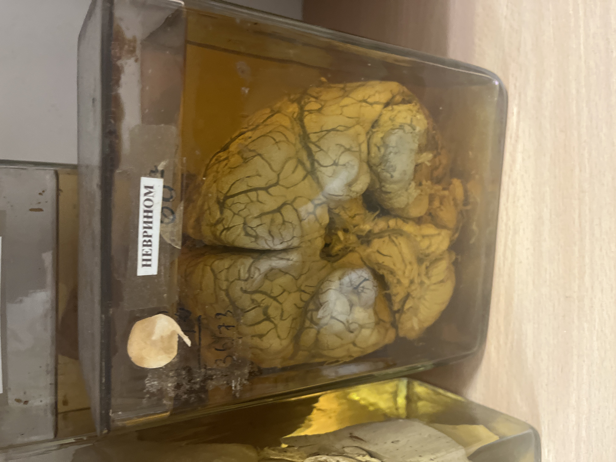 A human brain preserved in formaldehyde inside a clear glass jar is on display, likely at the Medical University of Plovdiv. The jar is labeled "НЕВРИНОМ" in Cyrillic letters and marked with "36173". The jar sits on a shelf next to other similar specimens. The background appears to be a simple, light-colored wall.