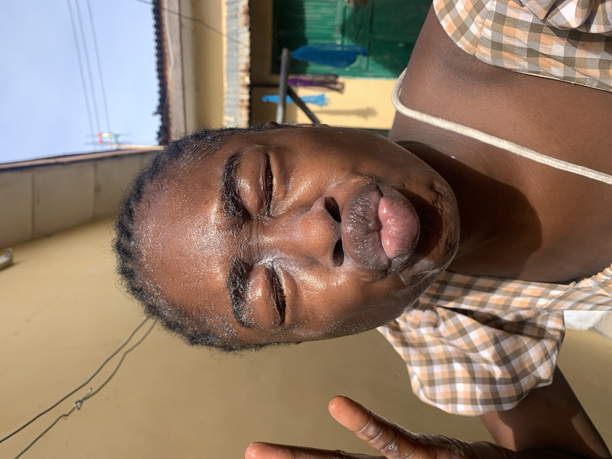A close-up shot shows a young Black woman in Rafin Par, Nigeria, with her eyes closed and lips pursed for a kiss. She is wearing a checkered top with puffed sleeves and has a peace sign gesture with her right hand. Her face is shiny, possibly from sweat or a product, and there are white streaks near her mouth and on her forehead. The background features a textured, light-colored wall, a section of a building with a corrugated metal roof, and what appear to be clothes drying on a line. The overall lighting suggests it is daytime, with strong sunlight.
