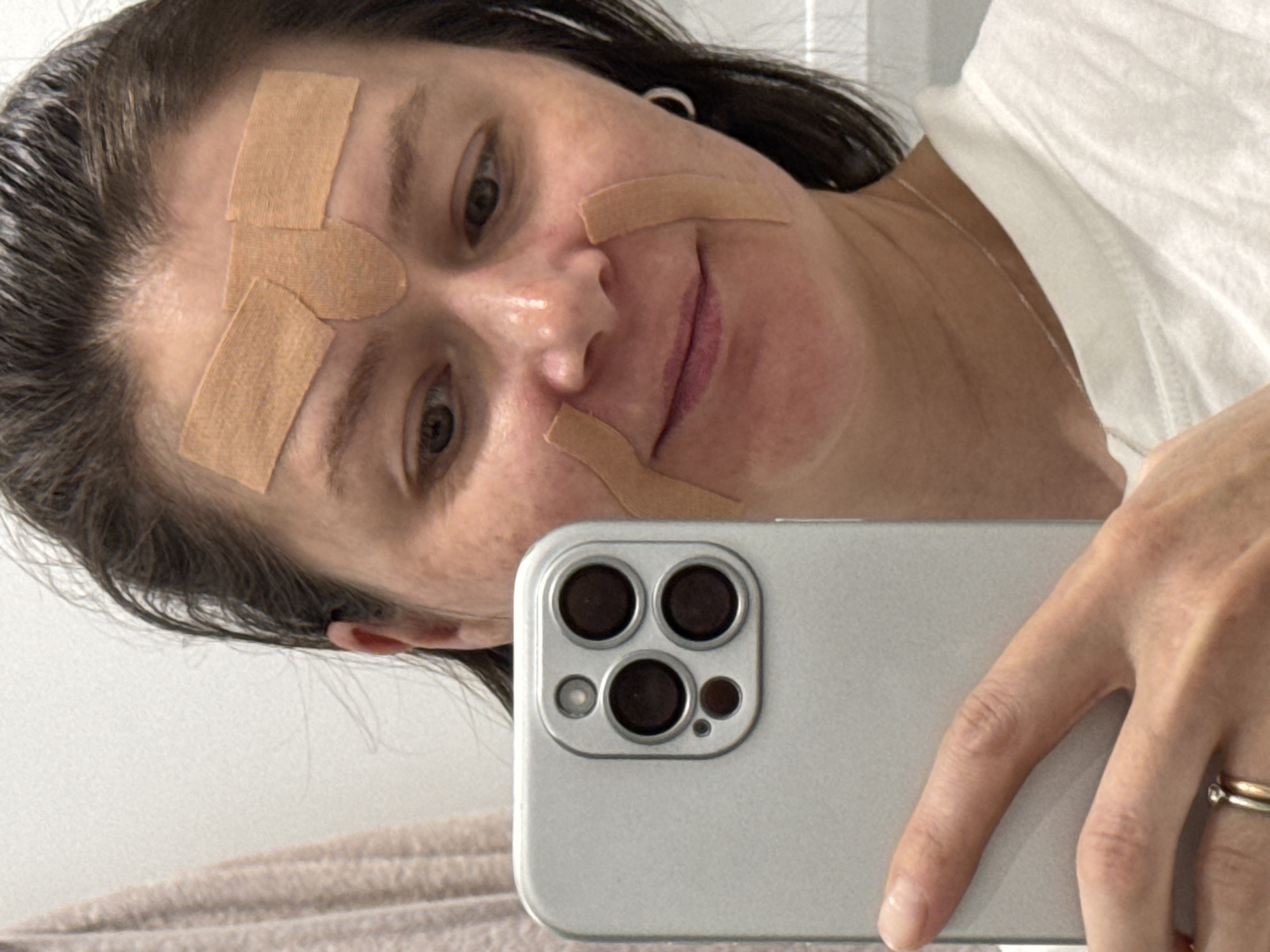 A person is taking a selfie. The person has several bandages on their face. They are holding a light-colored smartphone with a multi-lens camera system. The location is unknown and there is no evidence to suggest it is Izhevsk, Russia.
