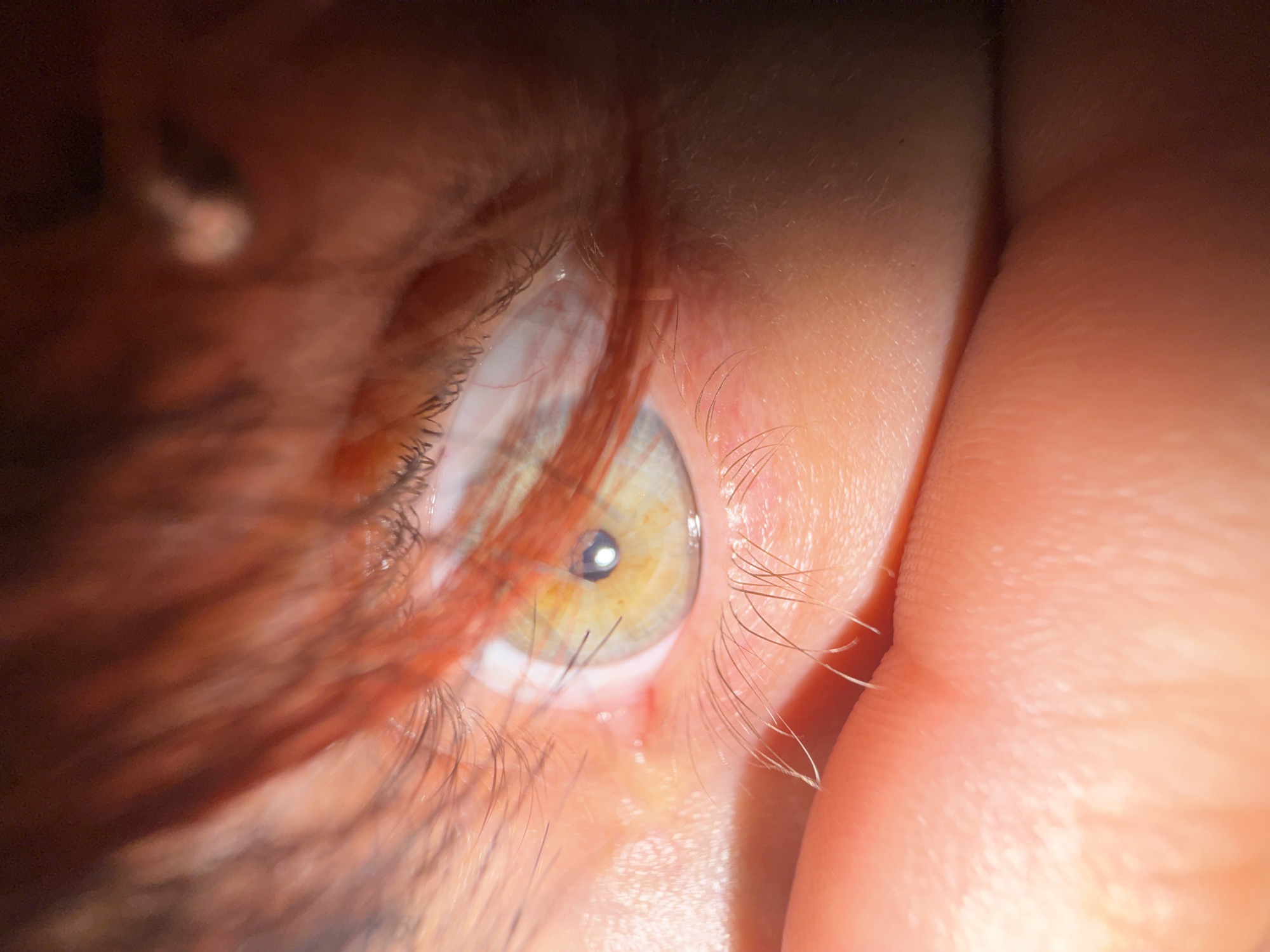 An extreme close-up photograph shows a left human eye with eyelashes, iris with a visible pupil, and surrounding skin and hair. The iris is a mix of green and yellow hues. Red hair strands are visible in the blurred foreground. A finger is retracting the eyelid. The location and city of Sofia, Bulgaria are not discernible from the image.