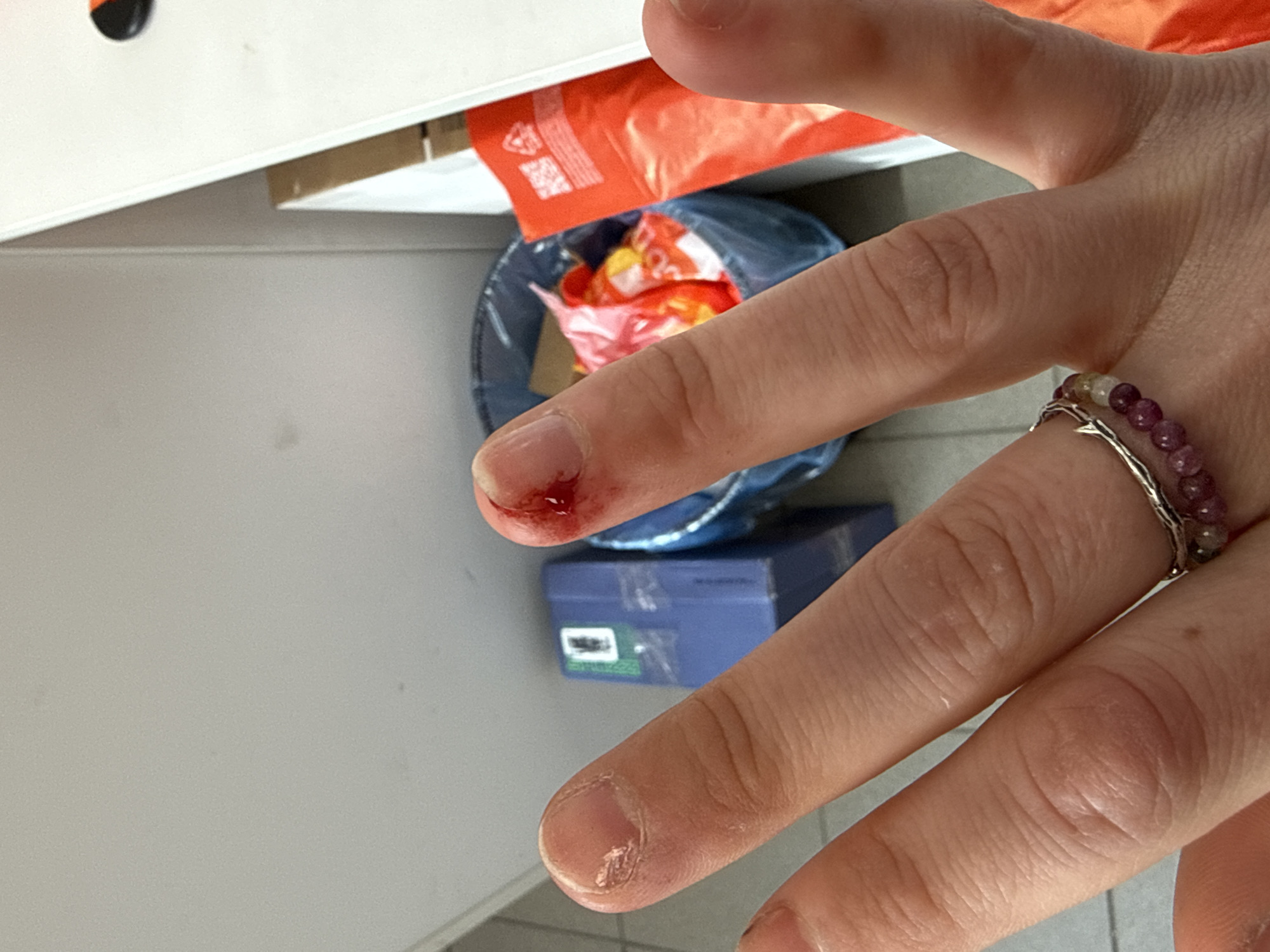 A close-up shot of a hand with a small cut on the index finger. A ring is worn on the ring finger. A blue waste bin containing orange and red packaging is visible in the background. A blue box is underneath the waste bin. The environment includes elements suggestive of a domestic or office interior, with a white surface visible on the left side. The location is not identifiable as Saint Petersburg, Russia, based on the visual elements.