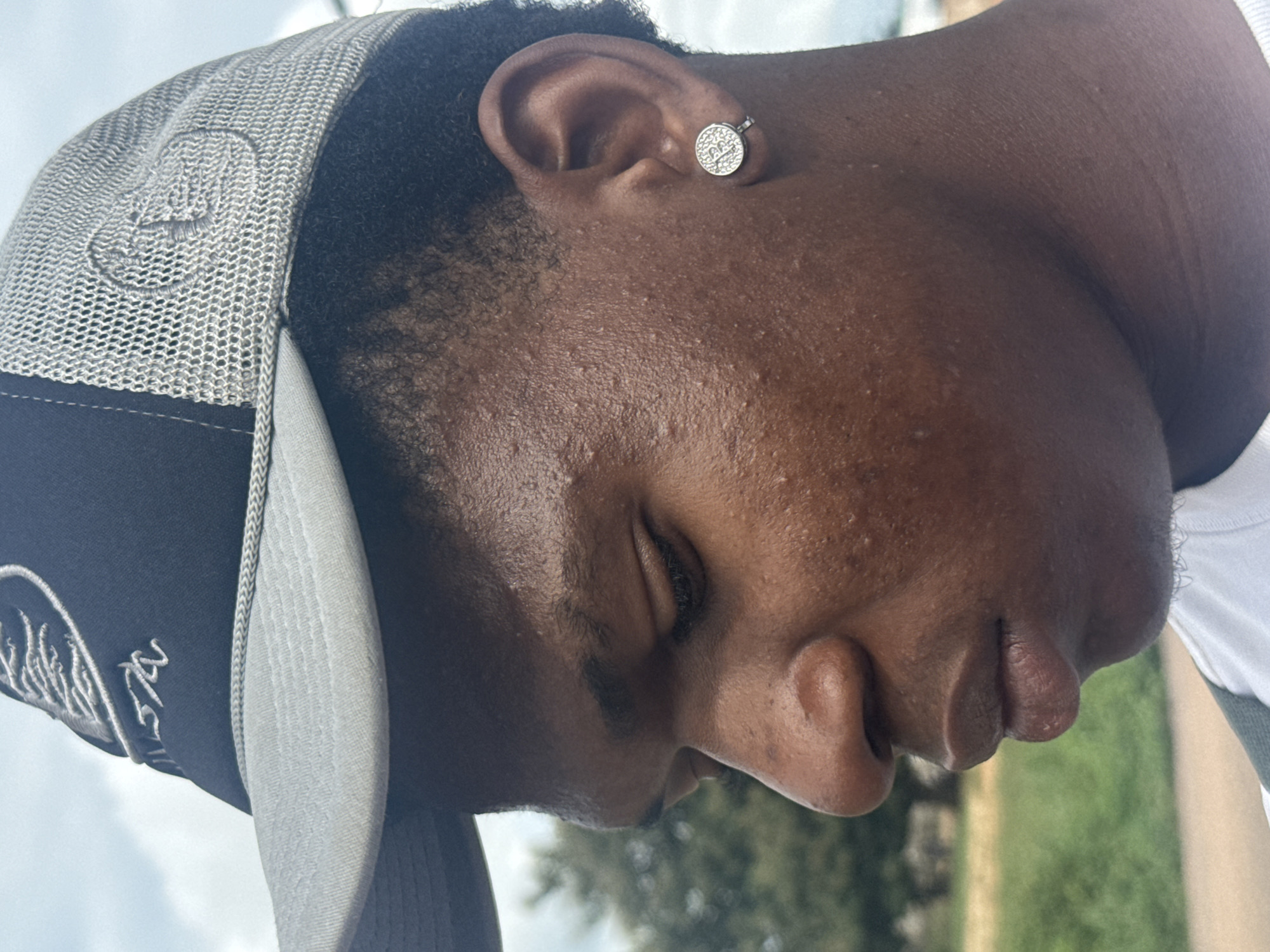 A medium close-up shot captures the profile of a young Black person wearing a gray and black trucker hat and a white t-shirt. The person's eyes are downcast, and they are looking to the left. They have a silver earring in their left ear. The background shows greenery and a cloudy sky, suggesting an outdoor setting in Ihiagwa, Nigeria. The lighting is bright, and there is a slight sheen on the person's skin, indicating sweat.