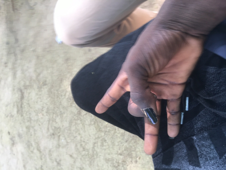 The scene, located in Pindiga, Nigeria, depicts a close-up, overhead view of two individuals. In the foreground, a dark-skinned left hand is prominently featured, forming a hand gesture where the index and middle fingers are extended upwards, the ring and pinky fingers are bent, and the thumb is extended downwards. The fingernail on the middle finger is painted with a dark, possibly black or navy, polish, exhibiting minor chips. This hand rests on the thigh of the individual, who is wearing black trousers with a subtle, dark geometric pattern. A small, light-colored piece of debris is visible on the fabric of the black trousers. To the right, partially visible, is the leg of a second individual, clad in light-colored, possibly beige or khaki, trousers. The background consists of a blurry, light-colored, granular surface consistent with dirt or sand. No other individuals or objects are discernible.