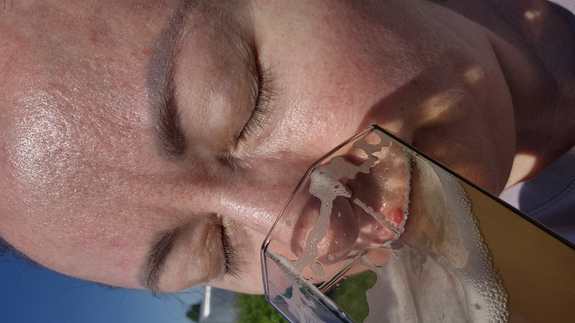 The image presents a close-up, rotated view of an adult's face, with eyes closed and dark eyelashes visible. The person's skin shows natural texture, including visible pores and some redness, particularly on the cheek and forehead. A dark, well-defined eyebrow is also prominent.
A clear glass, likely a beer glass, containing a golden liquid and residue of foam along its inner surface, is held against or very near the person's left cheek and ear area. A small, distinct red mark or blemish is visible on the skin just above the edge of the glass.
The scene is illuminated by bright sunlight, casting sharp highlights on the skin and the glass, suggesting it is daytime and sunny. The background is blurred but shows hints of a blue sky and green foliage, indicating an outdoor setting, possibly a garden, patio, or park.
The person's closed eyes could suggest relaxation, deep concentration on a sensation (perhaps the coolness of the glass), or a moment of repose. There is no visible text in the image. The provided context indicates the location as Novo stroika, Russia, though no specific visual cues in the image confirm this location.