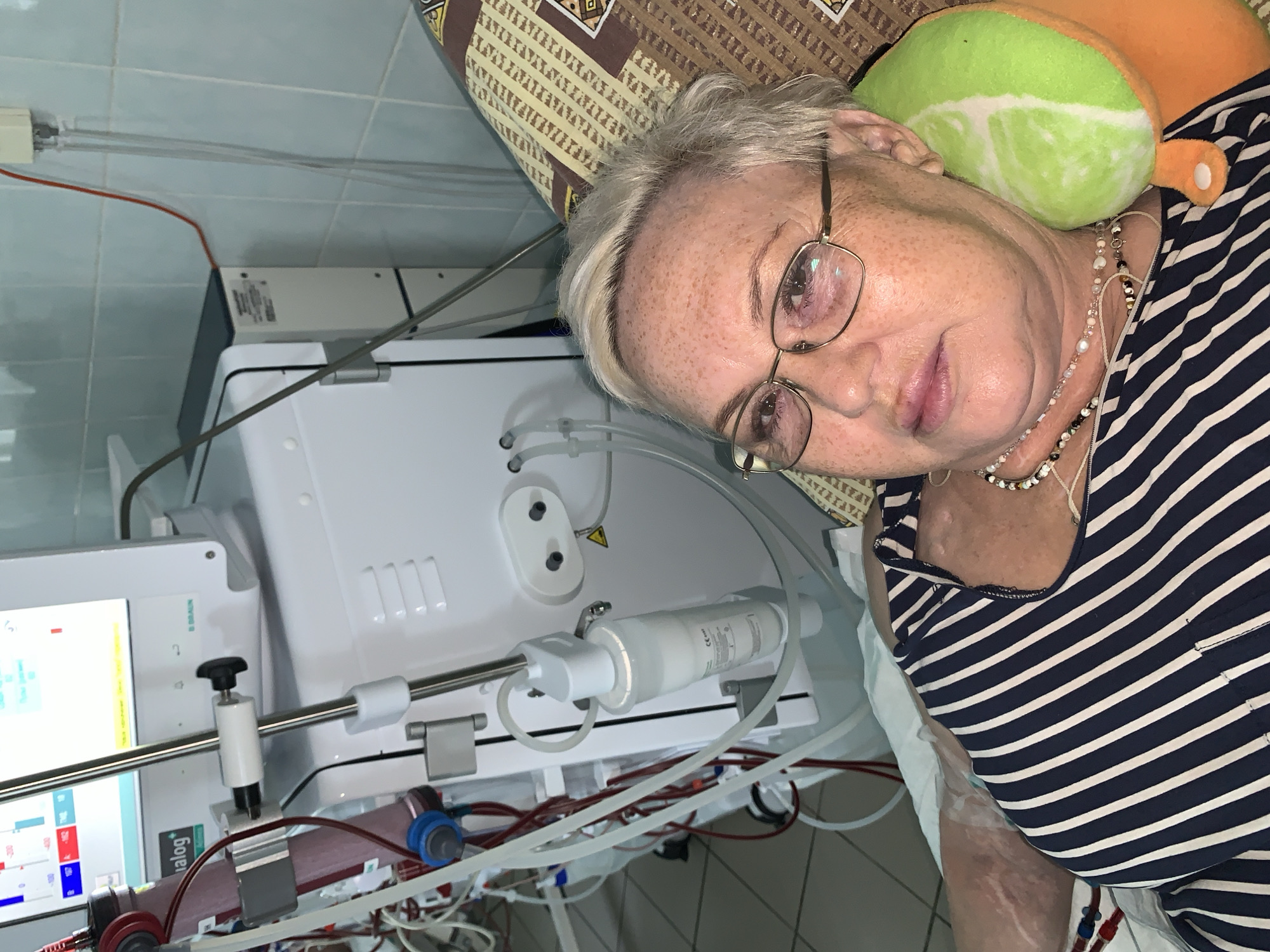 The image shows an elderly woman lying on a bed in a medical setting. She is wearing glasses and a striped shirt, and has a lime-shaped pillow under her head. A dialysis machine is visible next to her with visible tubing and red fluid. The wall behind the machine is tiled. The presence of the dialysis machine suggests a healthcare facility, possibly in the city of Chaikovsky, Russia. The location is assumed from the request.