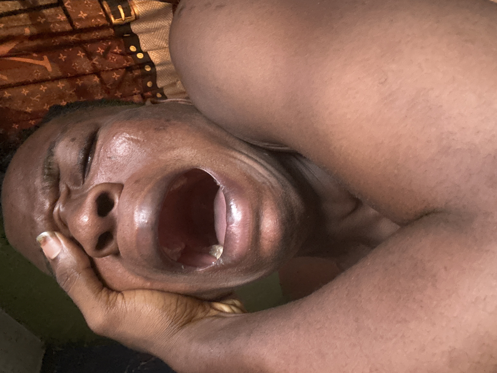 The media file is a close-up, overhead shot of a person's face and upper body. The person is lying down, with their head tilted back and their mouth open in a wide yawn. Their eyes are closed, and their hand is resting on their cheek. The person has dark skin, and their fingernails are visible. They are wearing a patterned fabric, possibly a blanket or bedsheet, which has a repeating pattern of dark brown and lighter brown motifs. A dark brown belt with gold buckle and gold studs is visible on this fabric. The lighting is warm and appears to be artificial, suggesting it might be indoors. The overall impression is one of drowsiness or exhaustion. No text is visible in the image. The location context is Ikorodu, Nigeria.