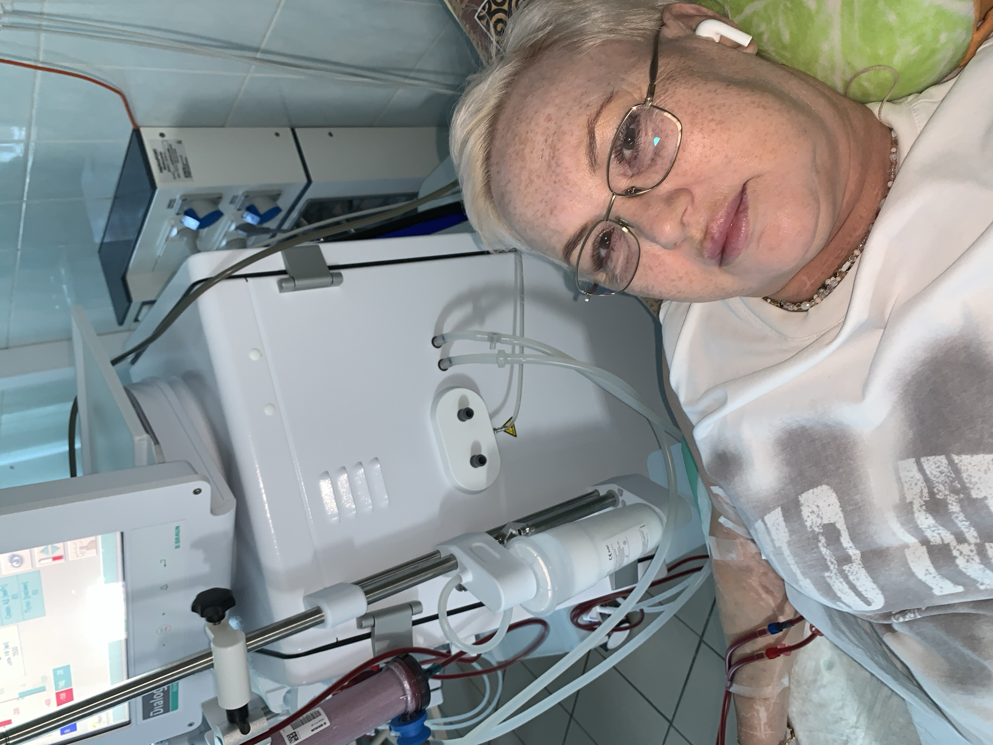 The image shows a woman lying in what appears to be a medical setting, possibly undergoing dialysis. She is wearing glasses and has a wireless earbud in her ear. She is connected to a medical machine with tubes and filters visible. The machine has a screen and various control components. Based on available information, it is possible that this scene is in a medical facility in the city of Chaikovsky, Russia. The environment includes tile flooring and medical equipment, suggesting a hospital or clinic. The woman's arm is visible, with tubes connected to her veins, indicating a medical procedure is in progress.