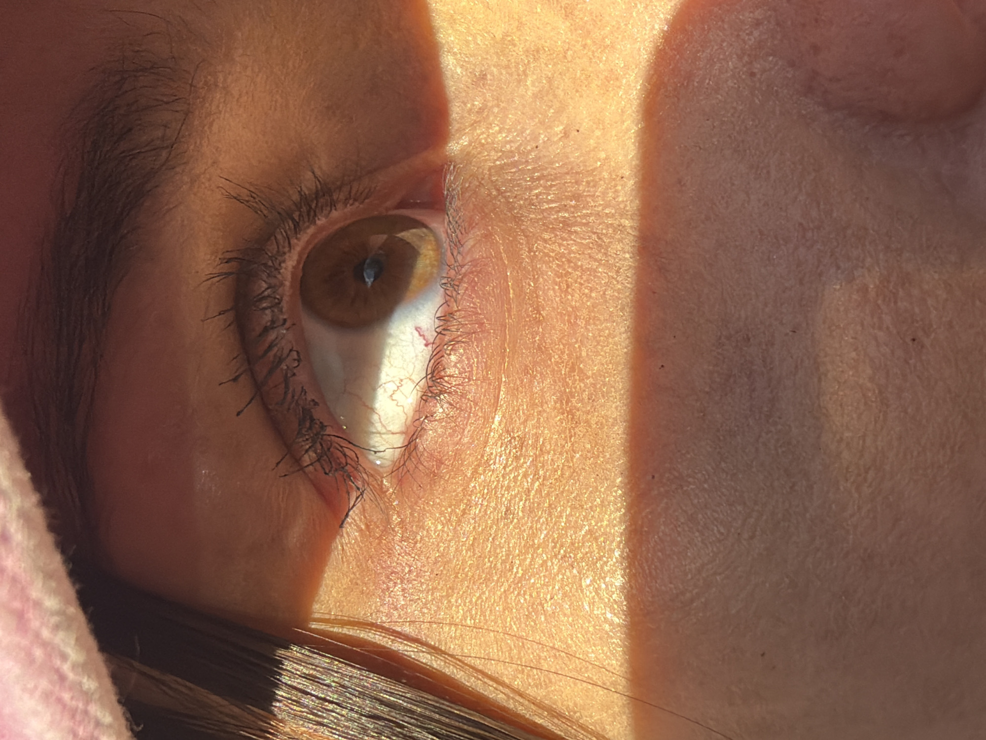 A close-up shot of a human eye, specifically the right eye, is partially illuminated by sunlight. The iris is brown with a visible reflection. The sclera (white part) shows some blood vessels. Eyelashes are visible along the lower and upper eyelids. The skin around the eye is textured, with some evidence of pores and fine lines. A shadow is cast across the right side of the face. Brown hair is partially visible in the lower part of the frame. There is no indication in this image of the location being Saint Petersburg, Russia.