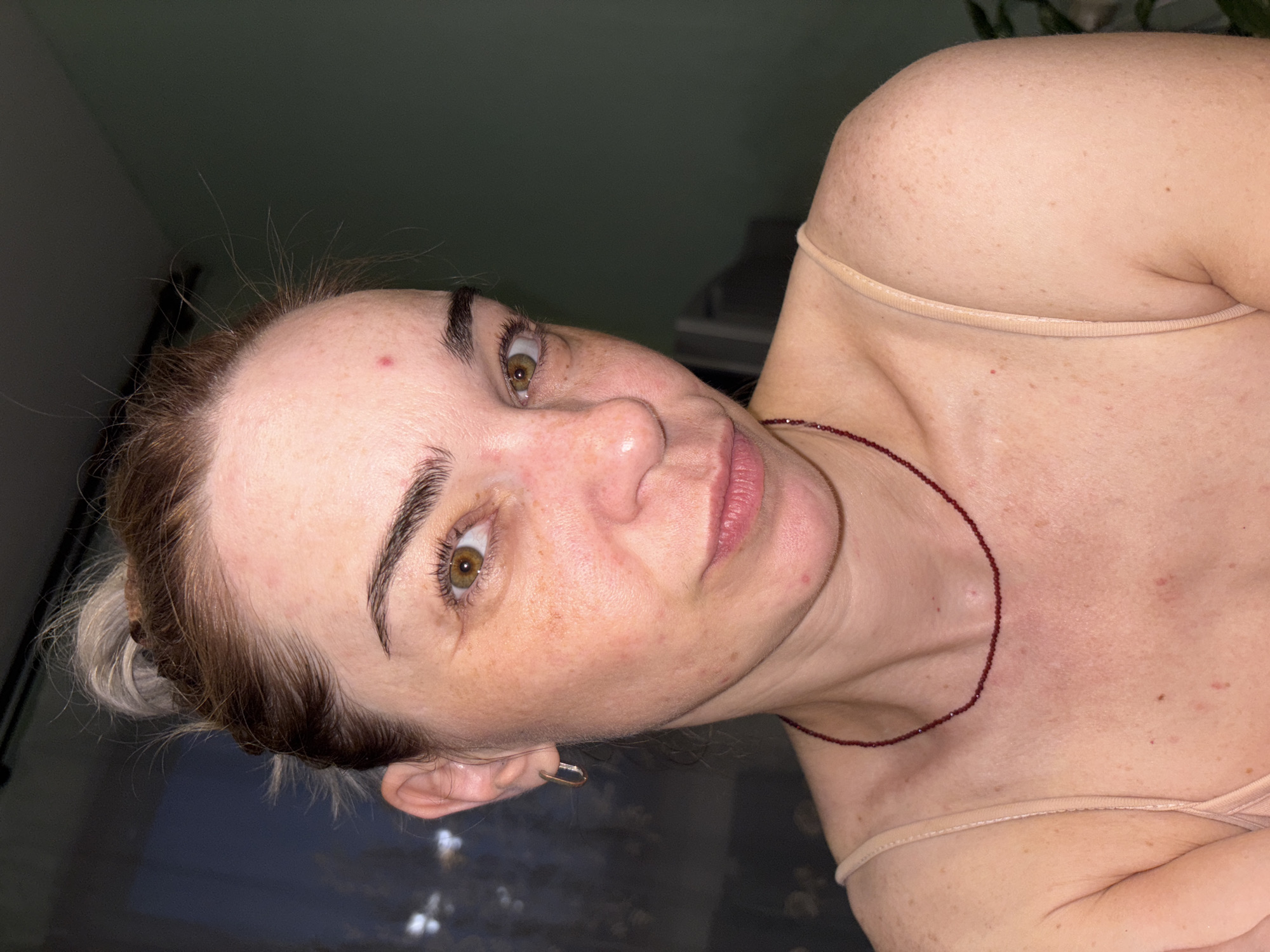 A medium close-up, head-and-shoulders shot features a woman with light skin, brown hair pulled up into a bun, and light brown eyes. She is wearing a tan camisole with thin straps and a thin, dark red beaded necklace. The woman has freckles and several blemishes on her face, neck, and chest. She is looking directly at the camera with a slight smile. The background is dark, with a hint of a window on the left and a green wall on the right. There is no indication of the location being in a city.