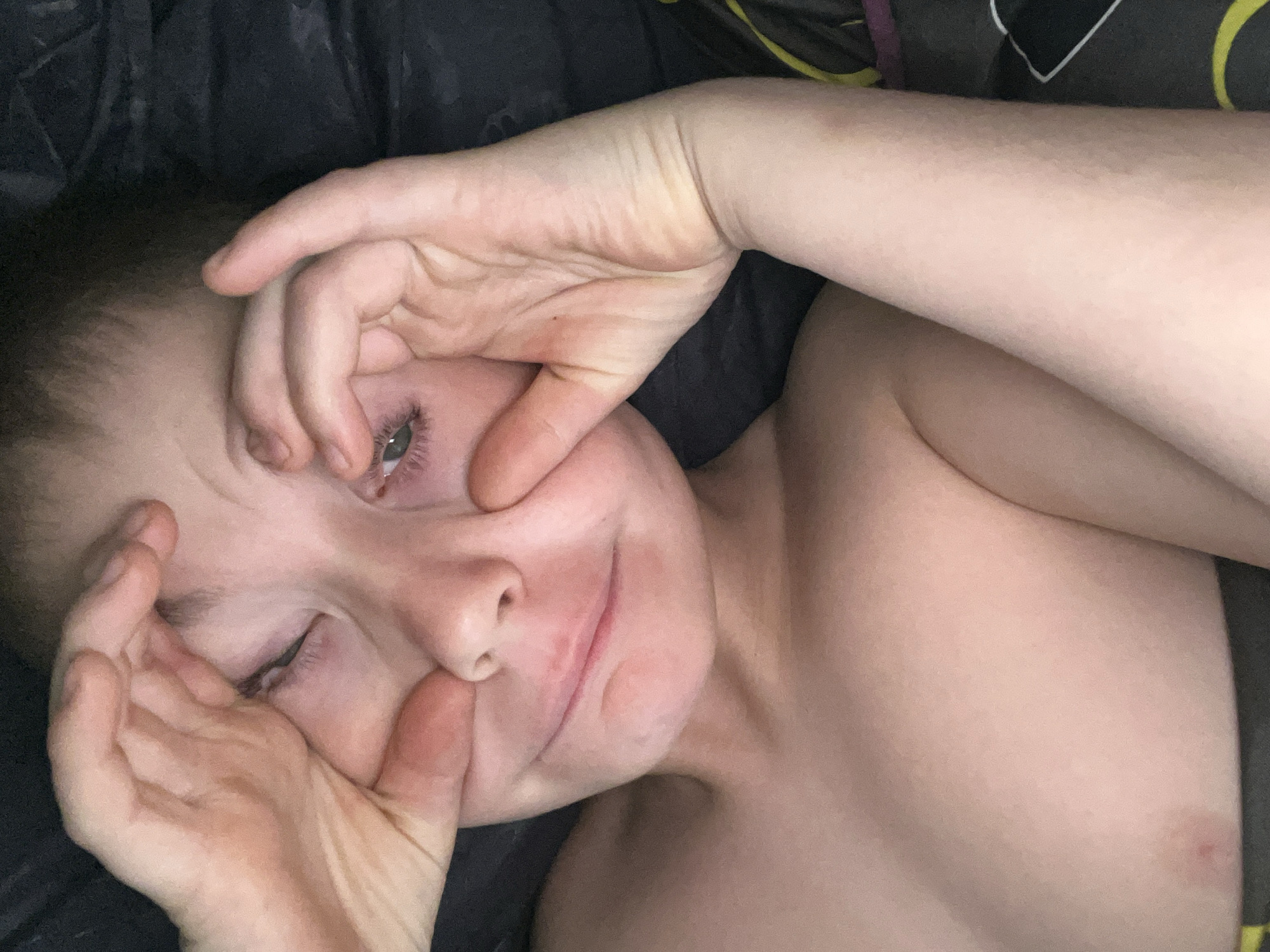 A playful portrait captures a young individual, likely a child or young adolescent, with fair skin, light brown hair, and green eyes, in Фоки, Russia. The subject is lying down on dark bedding, looking directly at the camera. Their hands are actively engaged in distorting their facial features, pulling the skin around their eyes and mouth. The left eye (viewer's left) is wide open, showcasing its green iris, while the right eye appears squinted or closed, contributing to a humorous and silly expression. A slight smirk is visible on their face. The upper body, including the shoulders and chest, is bare, revealing smooth, fair skin with a small reddish mark on the right chest area and a faint reddish patch near the mouth where fingers are pressing. The background is composed of dark, likely black or dark gray, fabric, suggesting an indoor setting with low light. No text is visible.