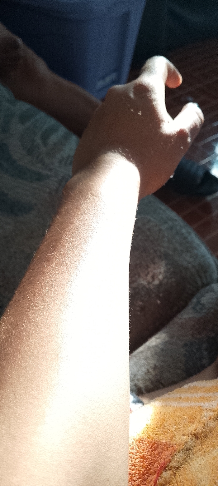 A forearm and hand are bathed in sunlight, with visible fine hairs. The hand is slightly curled with fingers bent. A portion of another arm is visible in the background, along with what appears to be a blue shirt. The arm rests against a textured surface, and there is a glimpse of a striped orange and white object in the lower right corner.