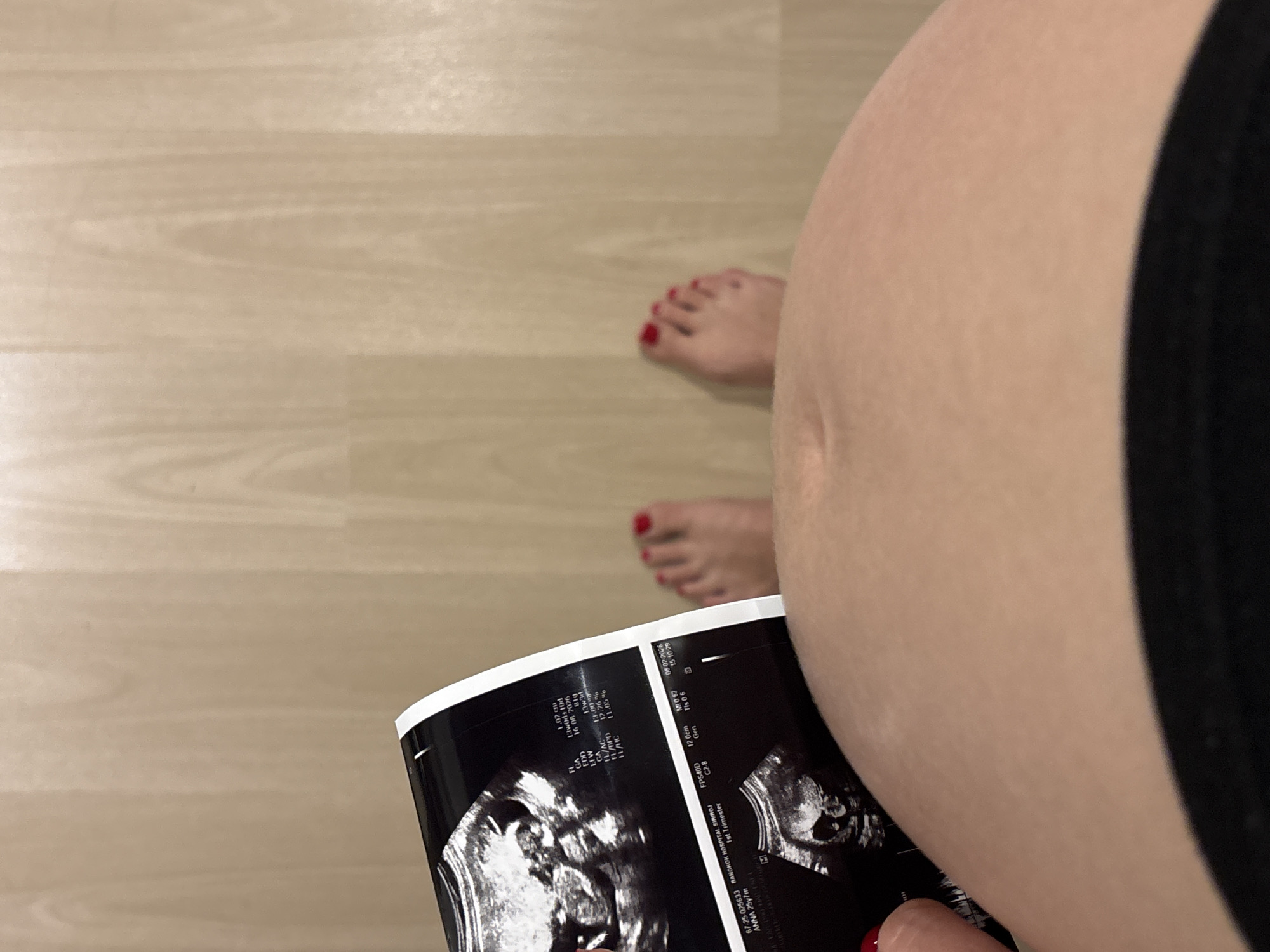 The image captures a top-down view of a pregnant person's belly, feet, and ultrasound scans against a light-colored wooden floor. The person's bare feet, adorned with red nail polish, are visible towards the upper middle of the frame. A rounded pregnant belly fills the right side of the image, partially obscured by a black garment, likely shorts or leggings.
The focal point is a sheet of ultrasound printouts held by the person, showcasing two fetal images. The scans contain detailed medical information. Visible text from the ultrasound reports includes the hospital name "BANGKOK HOSPITAL SIRIROJ," the patient's name and age "ANNA 25y7m," and the indication "1st Trimester." Key pregnancy details noted are a Gestational Age (GA) of "13w0d+10d" or "13w3d" and an Estimated Due Date (EDD) of "16 08 2026." The scan itself was conducted on "08-02-2026" at "15:10:29." Various measurements like "FI 1.02 cm," "IL/AC 13.00," "FL/BPD 12.26," and "FL/HC 11.05%" are also discernible, along with ultrasound technical parameters such as "FPS40D," "C2-8," and "MI 0 62."
The scene evokes a personal and intimate moment, likely a pregnancy announcement or a private reflection on the journey, situated indoors, possibly in Choeng Thale, Thailand, as suggested by the hospital's location.
