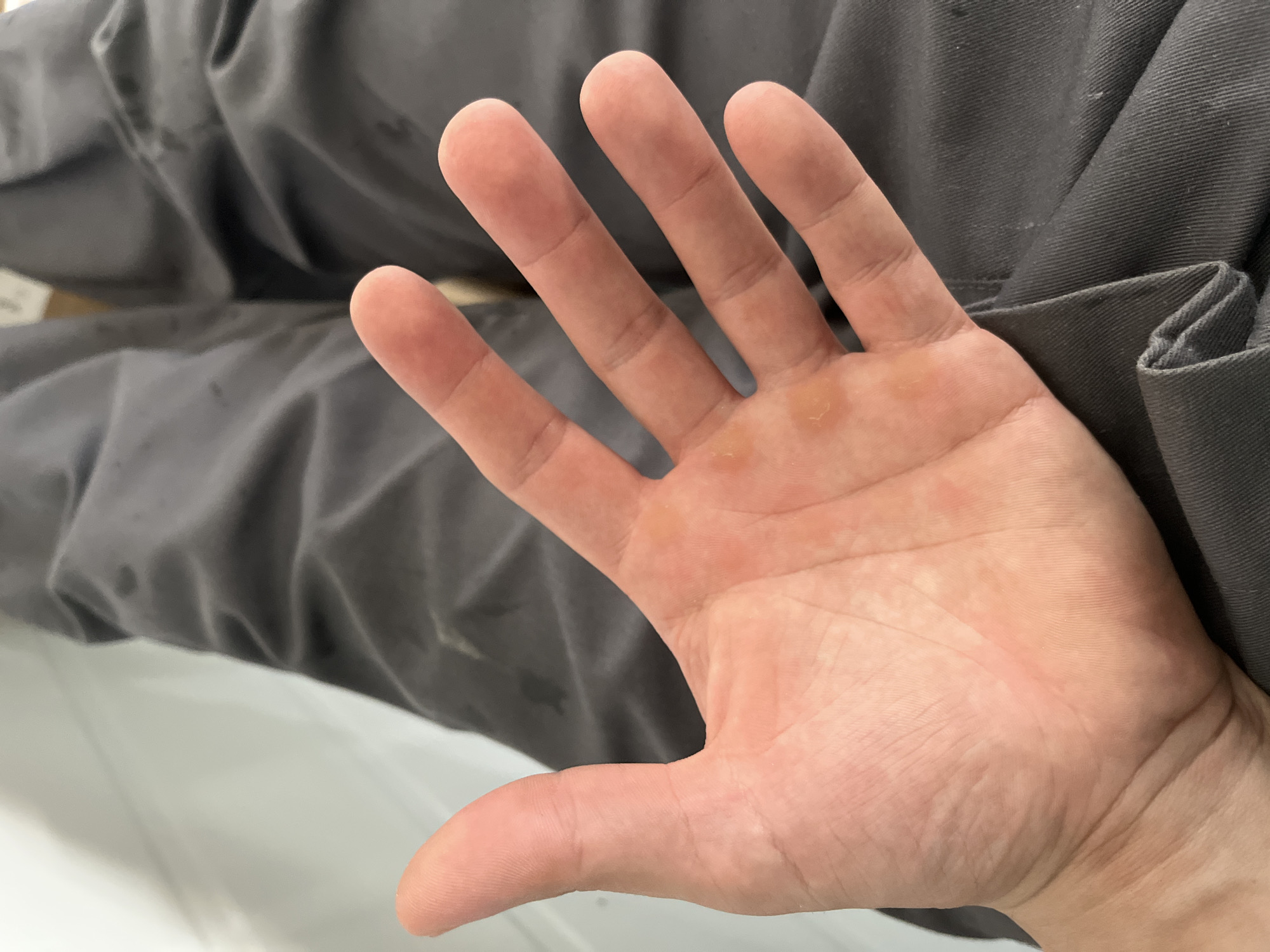 The image shows a close-up of a person's palm, revealing calluses on the skin, particularly on the palm and the base of the fingers. The hand is slightly cupped. The person is wearing dark gray pants, which are creased and textured, suggesting they might be work pants or denim. The background is out of focus and appears to be a light-colored wall or surface, possibly indoors. There is no visible indication of the location being in Kyiv, Ukraine. The scene is a static, close-up shot of a hand.