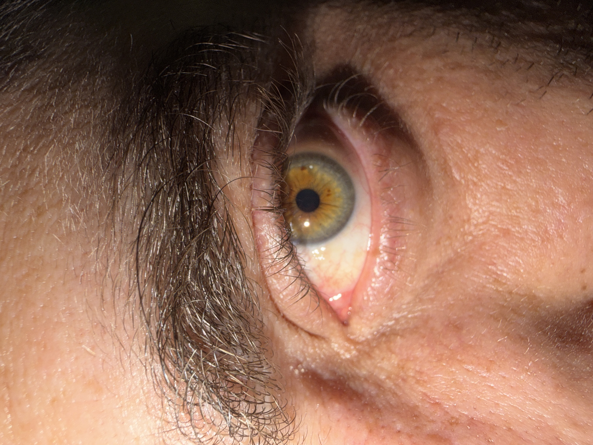 A close-up, eye-level, studio portrait shows a person's eye and surrounding facial features, including eyebrow and eyelashes. The subject's eye is the central focus, with a heterochromic iris, featuring a yellowish-green outer ring and a blueish-grey inner ring, surrounding a dark pupil. Small brown flecks are visible within the iris. The skin of the eyelid and surrounding cheek is visible, showing texture and some pores. The eyebrow is dark and thick, with visible individual hairs. The image is lit from the side, creating shadows that highlight the contours of the face. The background is dark and indistinct. No specific location in Yerevan, Armenia, can be determined from the image.