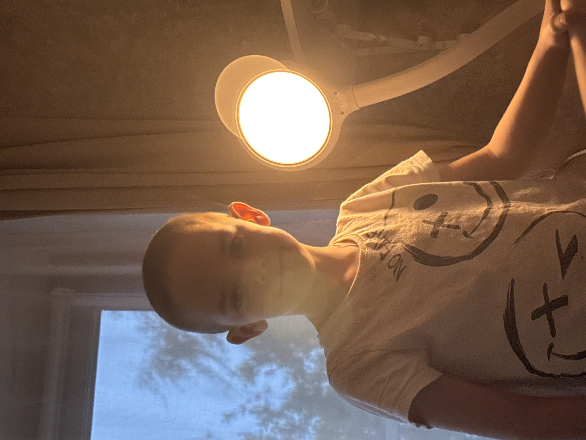 A pale-skinned child wearing a white t-shirt with a smiley face design is under a bright adjustable lamp. The window is behind the child with sky showing through. This event appears to be occurring indoors. There is no indication that this image was taken in Раздолье, Russia.