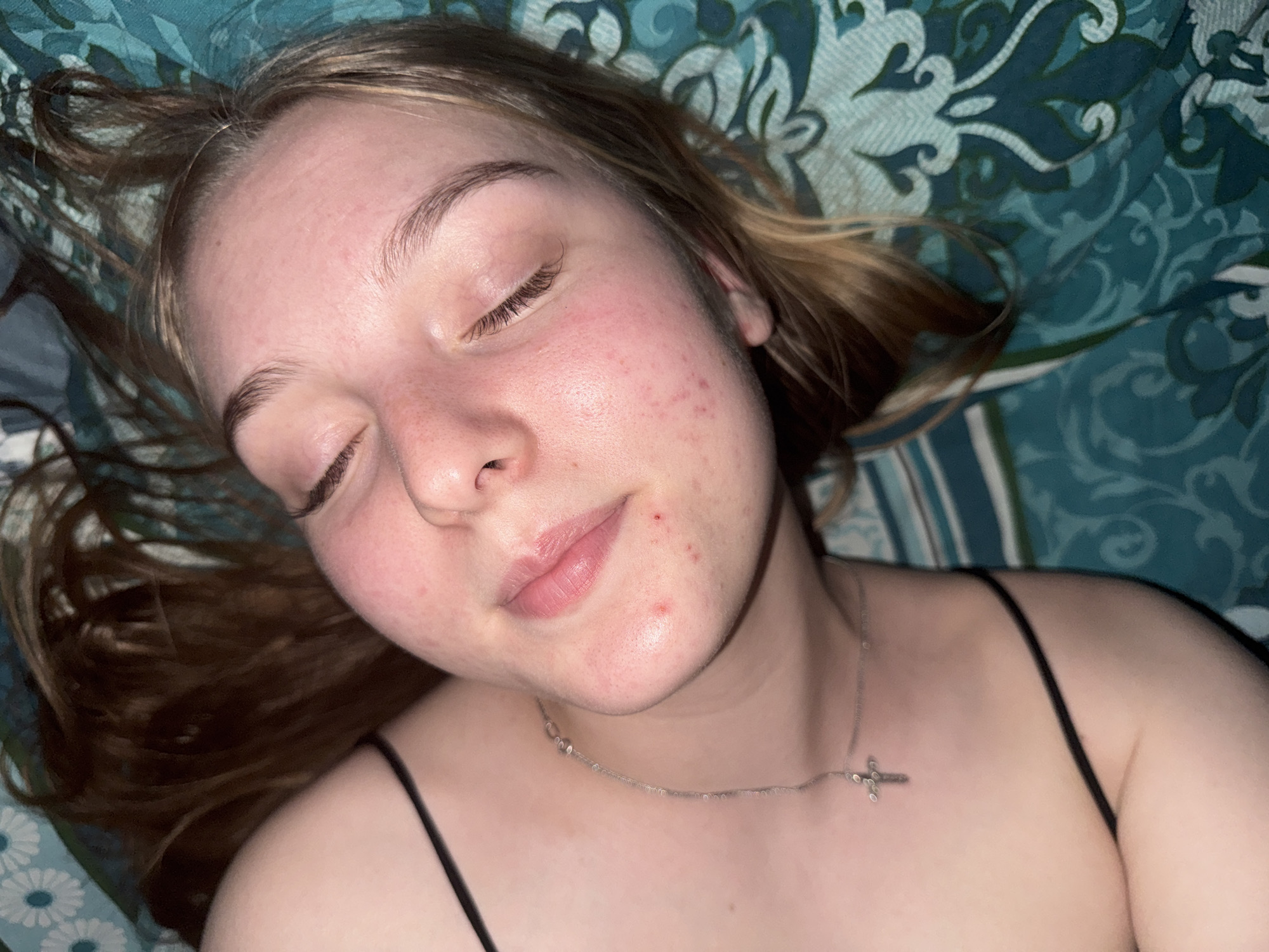 A young woman is lying down on a patterned fabric or bedding. She is fair-skinned with light blonde hair. Her eyes are closed. She is wearing a delicate silver necklace with a cross pendant and a black spaghetti-strap top. There are some blemishes and redness on her face. The background consists of various patterned fabrics in blue, green, and white. The photo was not taken in the city of Perm, Russia, as there are no indicators that would suggest this.
