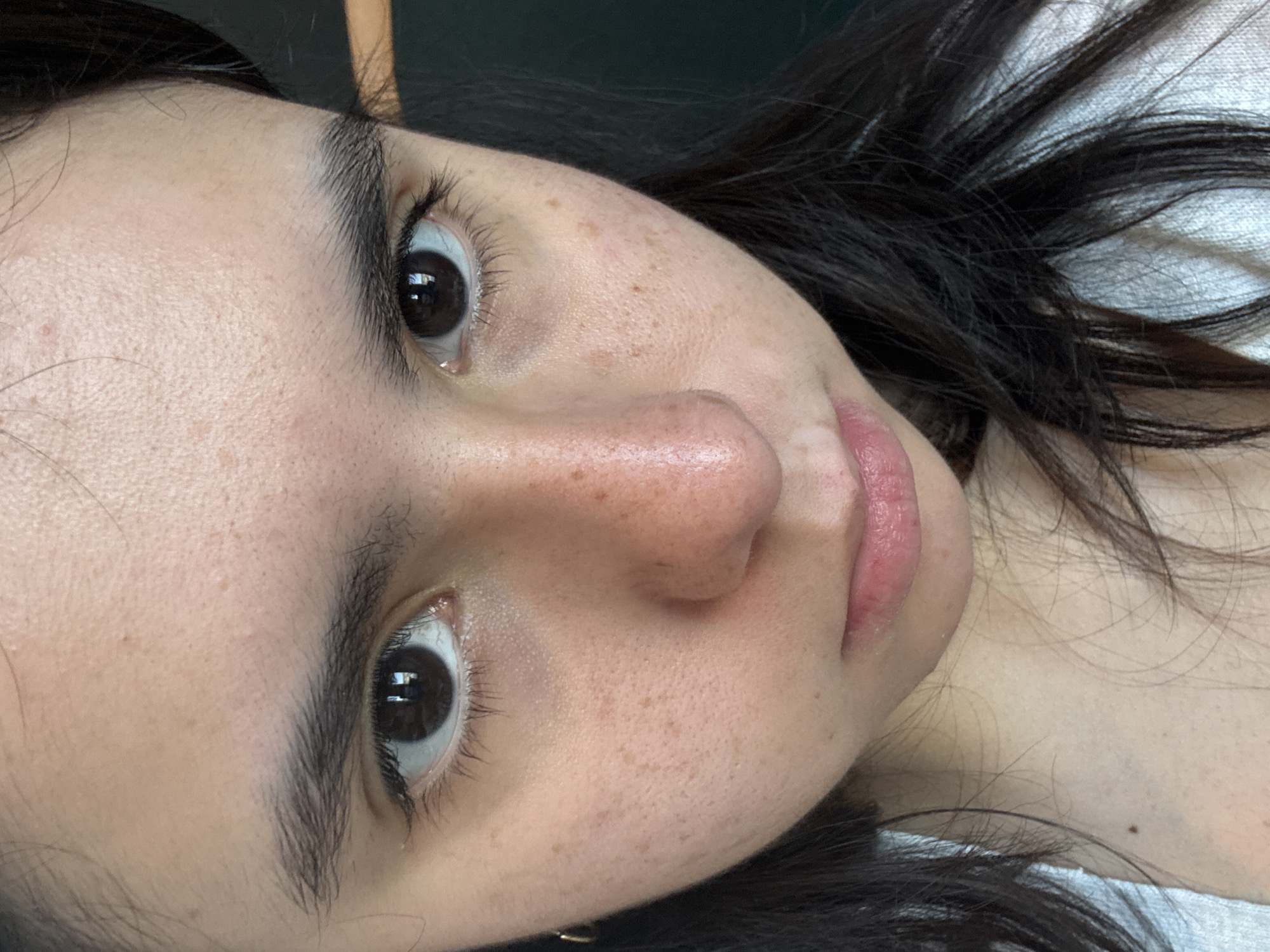 A close-up, upward-facing, tilted portrait of a young woman with fair skin and brown eyes. She has dark brown hair. Her face exhibits freckles and some skin imperfections. She appears to have naturally full lips with some discoloration. The background is indistinct, with dark green and light gray elements. No definitive location in Austin, United States of America can be determined from the image.