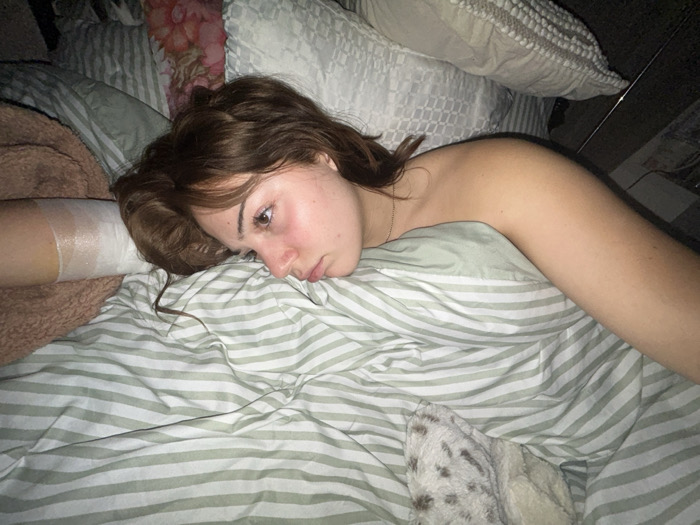 A young woman rests in bed, her face showing a slightly pensive expression. She lies amidst several pillows and a striped comforter. Her left arm is wrapped in a bandage. The lighting is dim, creating a soft and intimate atmosphere. The scene suggests a moment of rest or contemplation, possibly due to injury or illness.
