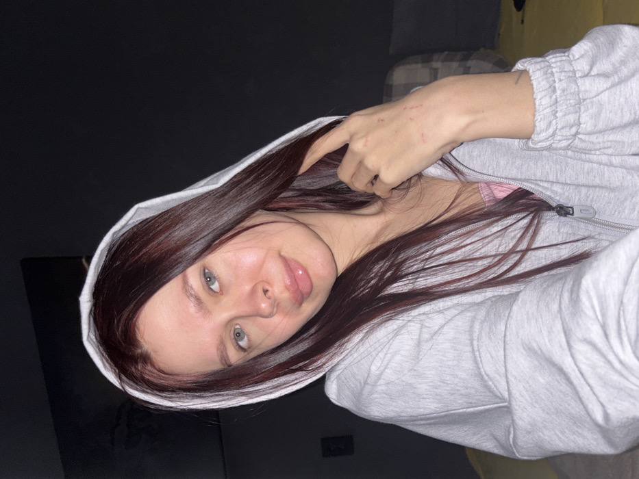 The image displays a young adult female captured in an indoor setting. No visual information within the image identifies its specific location as Chaikovsky, Russia, or any particular address within that city.
The subject has fair skin, light blue eyes, and long, dark red hair that extends over her shoulders. She wears a light grey zippered hooded sweatshirt, with the hood pulled up over her head. A pink garment is visible beneath the unzipped portion of the sweatshirt at her chest. She is looking directly at the camera with a subtle smile. Her right hand is raised to her neck, with her fingers lightly touching her hair. Multiple red linear marks, consistent with scratches, are present on the back of her right hand and wrist.
The background is dimly lit and predominantly dark. A rectangular dark object, possibly a television or monitor, is visible mounted on a wall in the upper left. To the right, a faint pattern suggestive of a plaid or checkered cushion or blanket is discernible. A bright yellow surface is visible in the lower right quadrant of the image.