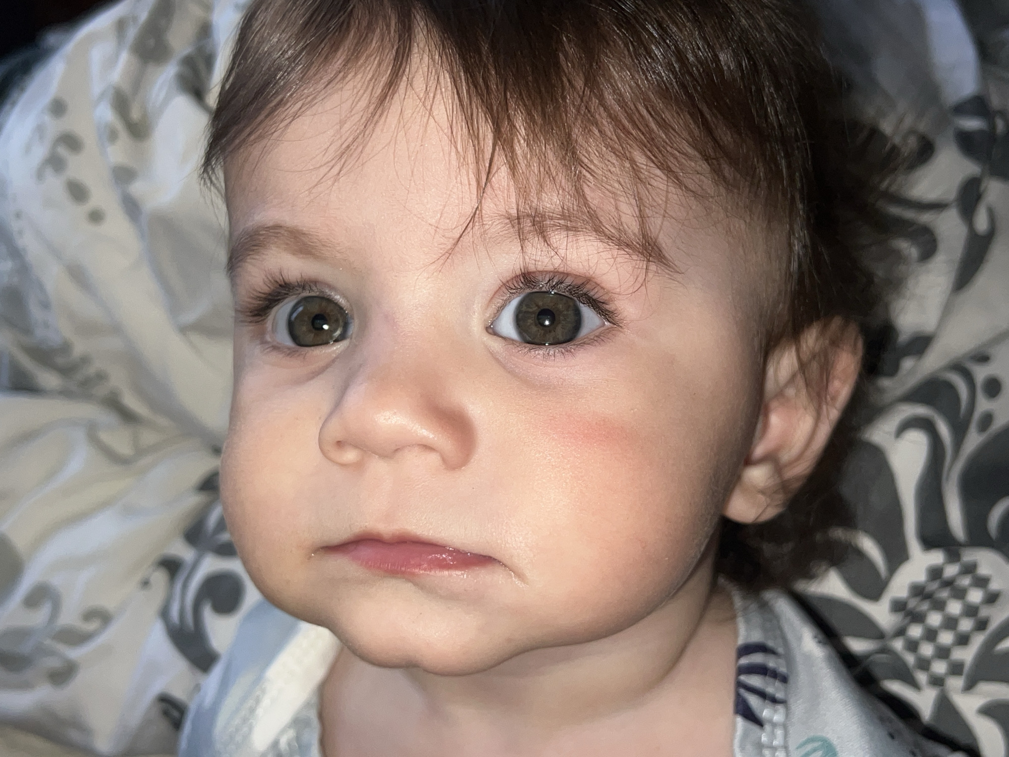 A close-up portrait of a baby with brown hair and eyes. The baby has fair skin with a slight redness on the right cheek. The baby is looking directly at the camera with a somewhat serious expression. The background consists of a patterned grey and white blanket. The baby is wearing a light-colored shirt with a patterned design. There is no clear indication of the location being Elena, Bulgaria or any other city.