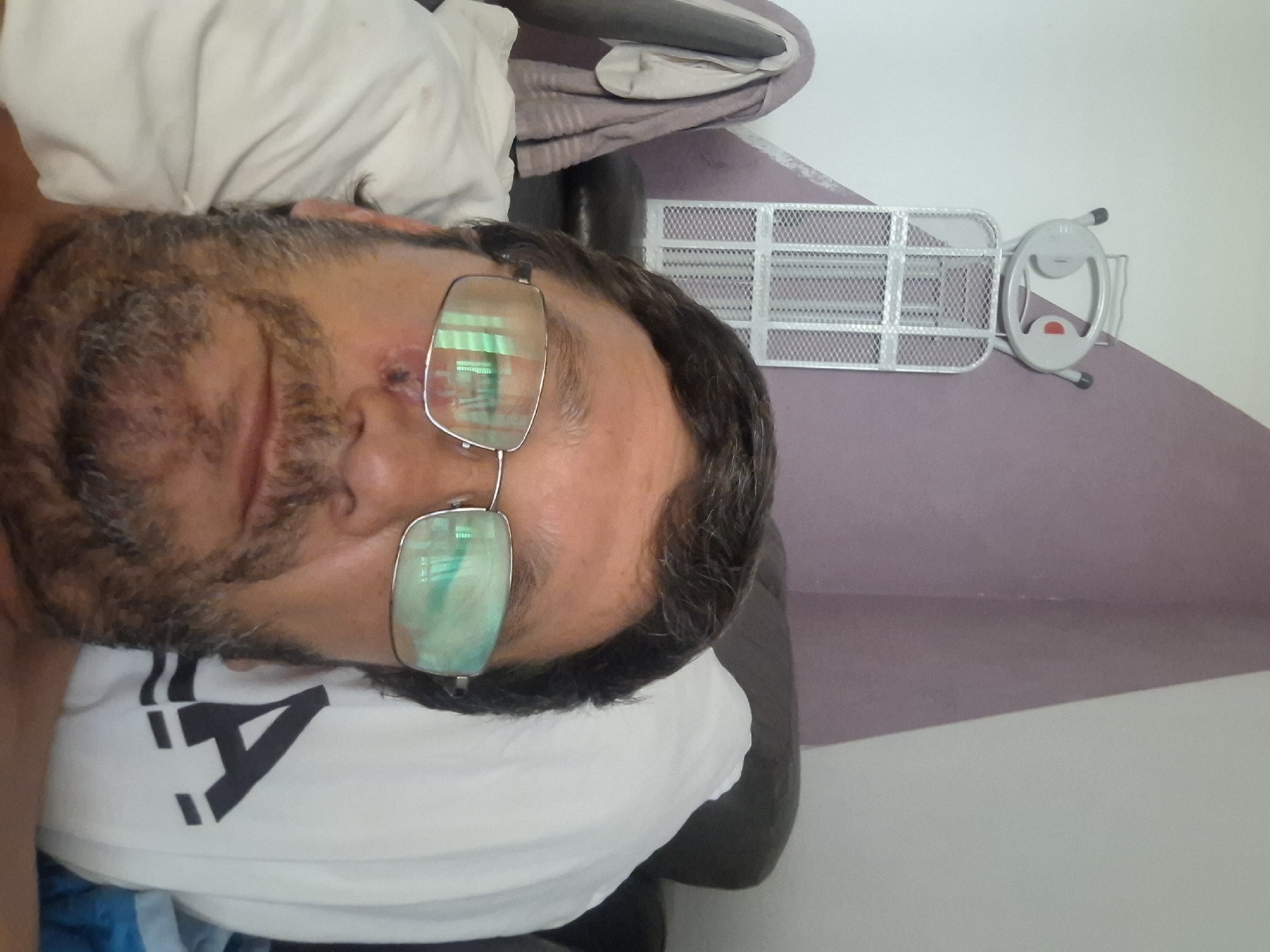 A medium-shot selfie shows a middle-aged man lying on a bed, with his head slightly tilted. He is wearing glasses with reflective lenses. A small wound or blemish is visible on his cheekbone. Behind him, a white pillow with a black logo is visible, and to his left, an ironing board is propped against a purple and white wall. The scene appears to be indoors, possibly in a bedroom in Yerocham, Israel.