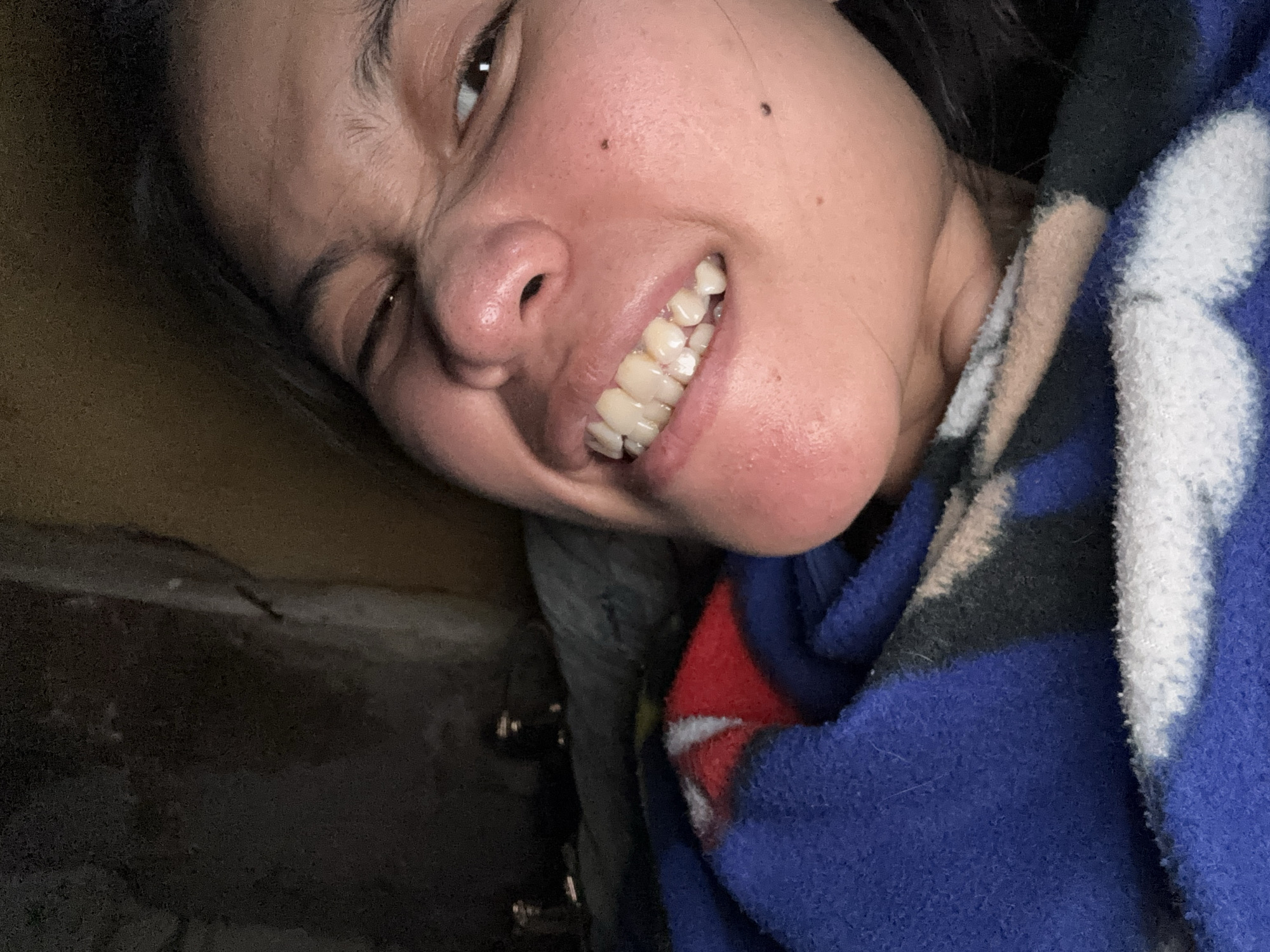 A close-up, low-angle, indoor, selfie-style photograph shows a person's face and upper chest. The person is looking towards the camera with a grimace, teeth bared, and eyes squinted. Their skin appears flushed, with some minor blemishes visible. A blue, red, and white patterned blanket is wrapped around their chest and neck area. The background is dark and out of focus, with hints of a textured wall and some reflective objects. The person's mouth is open, revealing teeth. The image does not contain information that allows for a specific location in East Jakarta, Indonesia.