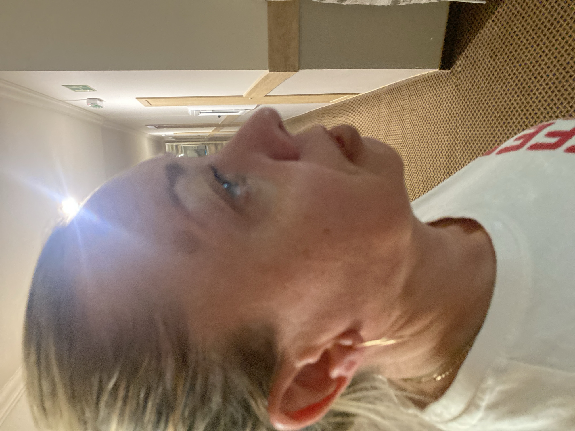 A woman with blonde hair is shown in profile, facing right. She is wearing a white t-shirt and a thin gold hoop earring. Her skin has a slightly reddish tone, and there are visible pores on her cheek. The background appears to be a hotel hallway with patterned carpet, beige walls, and wooden accents. An emergency exit sign is visible on the wall. The lighting is bright, with a light source casting a glare on the upper left portion of the image. There is no indication of the city of Nesebar, Bulgaria.