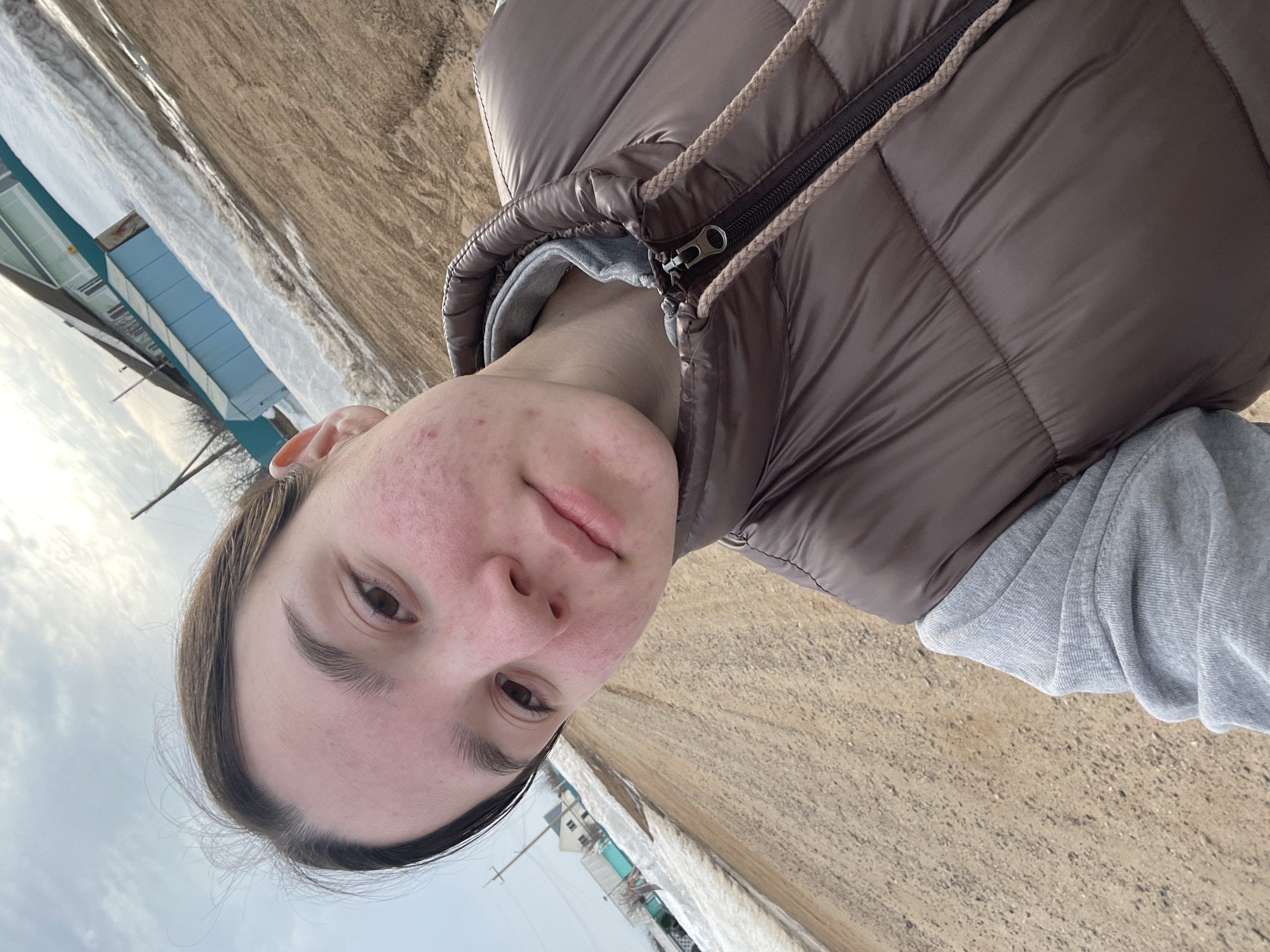The image is a close-up selfie of a person with visible acne and redness on their face. They are wearing a brown puffer jacket over a grey sweatshirt. The background shows a dirt road and a partly snowy area, with a few houses visible in the distance. Based on the location, it appears to be Ольховка, Russia, judging from the likely rural or semi-rural setting and the presence of snow.