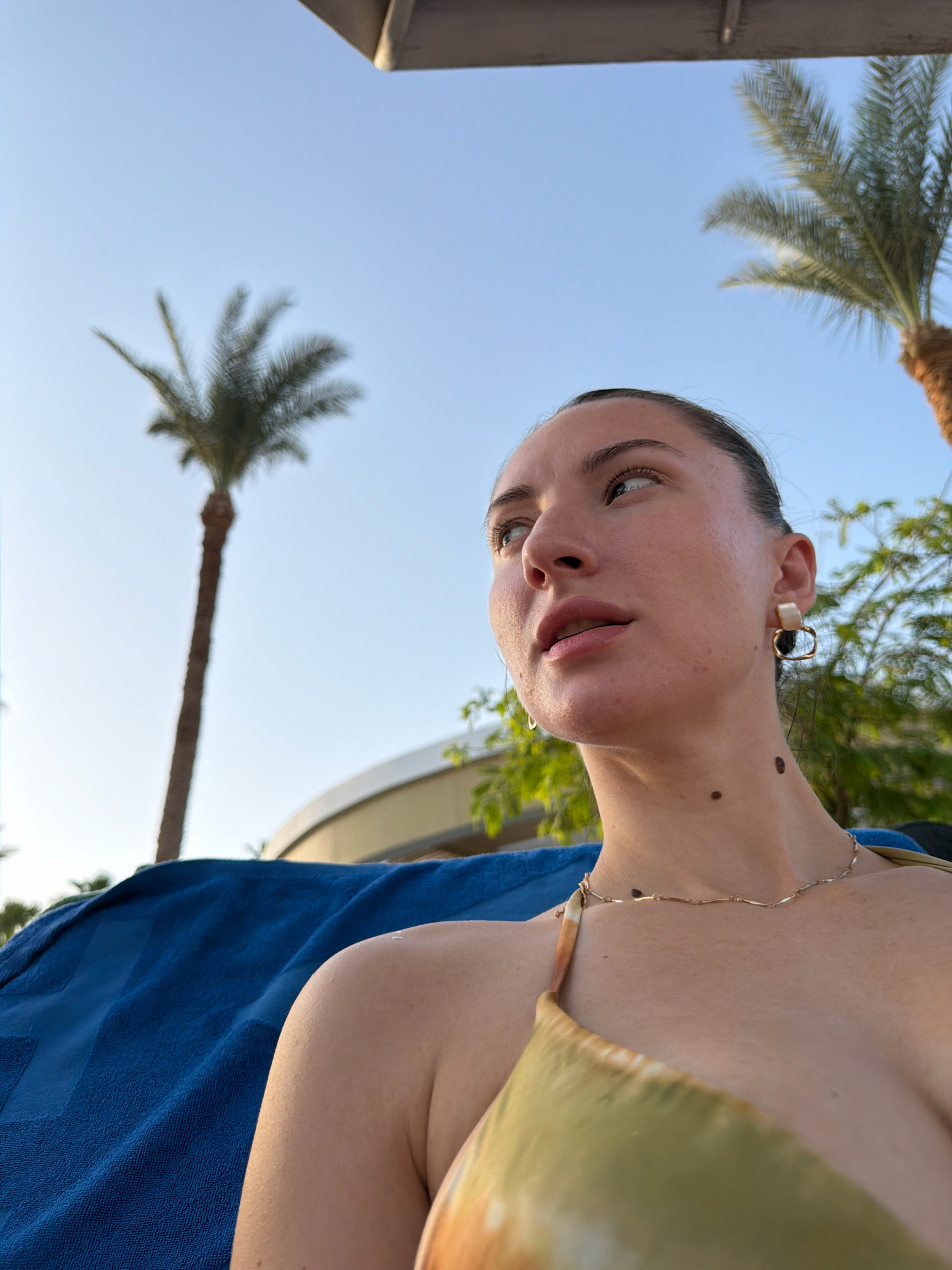 A young woman with dark hair pulled back gazes to her left, her face illuminated by natural light. She is wearing a light-colored bikini top with an abstract pattern and a delicate gold necklace. A large dark mole is visible on her neck, just below her jawline. She is reclining on a bright blue towel, likely on a lounge chair. The background features a clear blue sky with two palm trees, one tall and slender, and another to the right with a fuller crown. In the distance, a curved building with white trim is visible. The scene suggests a relaxed outdoor setting, possibly a resort or hotel in Sharm El Sheikh, Egypt, given the presence of palm trees and the bright, sunny atmosphere.