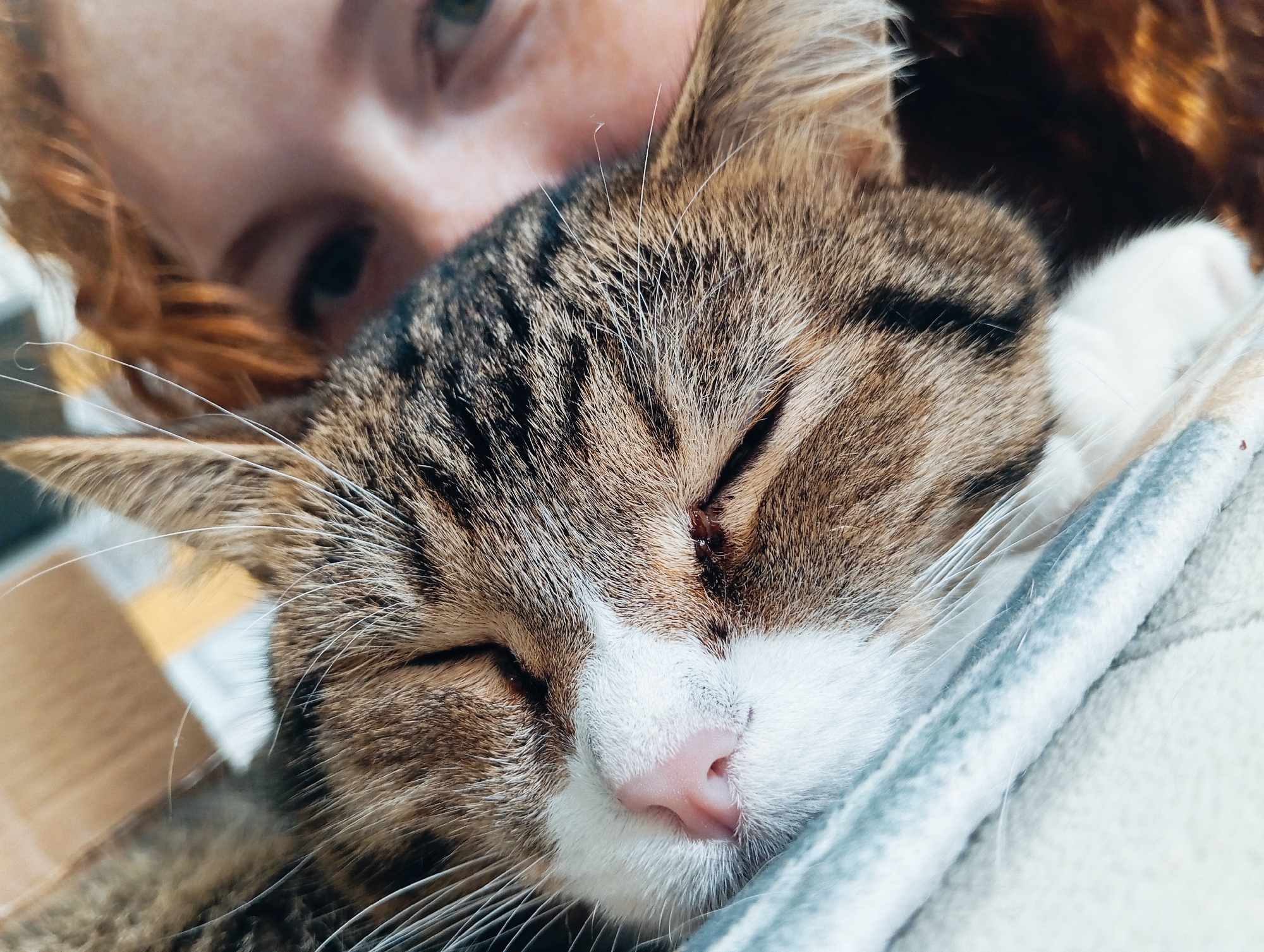 A close-up shot shows a sleeping brown tabby cat with a white muzzle and pink nose being held by a person with reddish-ginger hair and freckled skin. The person's green eye is partially visible. The cat is resting on a light-colored, textured surface, possibly a blanket. The location is not determinable from the image.
