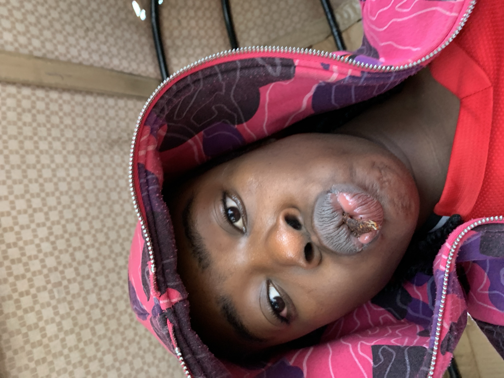 The image presents a rotated, close-up portrait of a person with dark skin, looking directly at the camera. The individual wears a hooded jacket featuring a distinct pink and purple camouflage-like pattern, with a silver zipper visible along the edge of the hood. Their eyes are wide and focused. A prominent dark, granular substance is visible on and around the person's lips, appearing concentrated at the center of the mouth. The lips themselves appear somewhat distended. The person's expression is neutral. The background features a light-colored surface with a subtle, repeating checkered pattern, suggesting an indoor setting. Indistinct dark objects are partially visible in the upper background. No specific time of day or external weather conditions can be determined from the image, and there is no visible text.