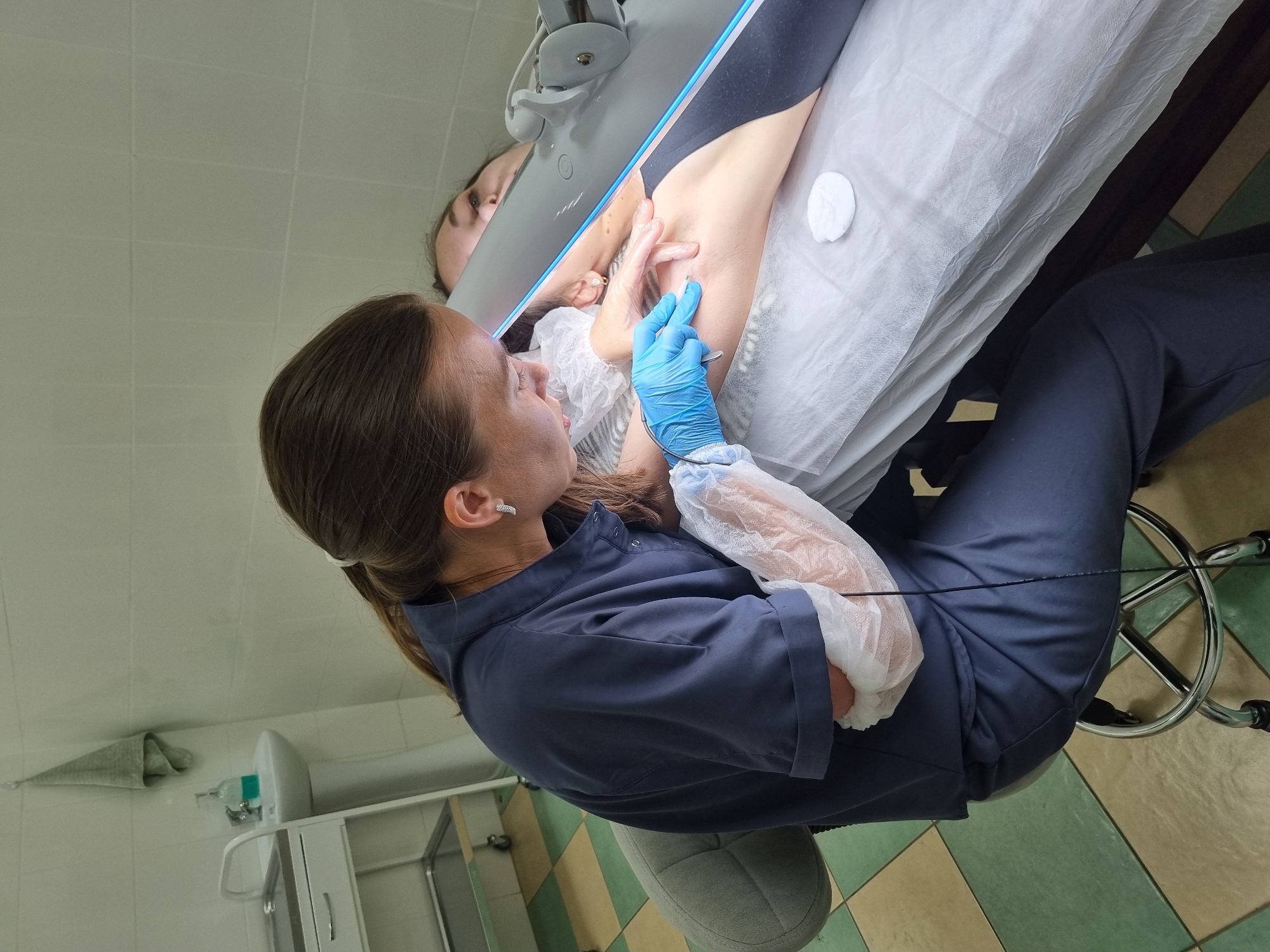 An individual, likely a medical or aesthetic professional, is performing a procedure on another individual lying down on a medical examination table. The professional is seated on a wheeled stool and is wearing a dark blue uniform, blue gloves, and disposable arm coverings. They are holding a tool and are focused on the armpit area of the person on the table. The person on the table is wearing dark clothing on their upper body and appears to be looking away from the camera. A bright light source with a blue trim is positioned between the two individuals, illuminating the procedure area. The room appears to be a medical or treatment facility, with tiled walls and flooring. In the background, a sink with a faucet and soap dispenser, and a rolling medical cart are visible. The scene is clinical and focused on the medical procedure. No specific location in Chaikovsky, Russia, can be identified from the image itself.