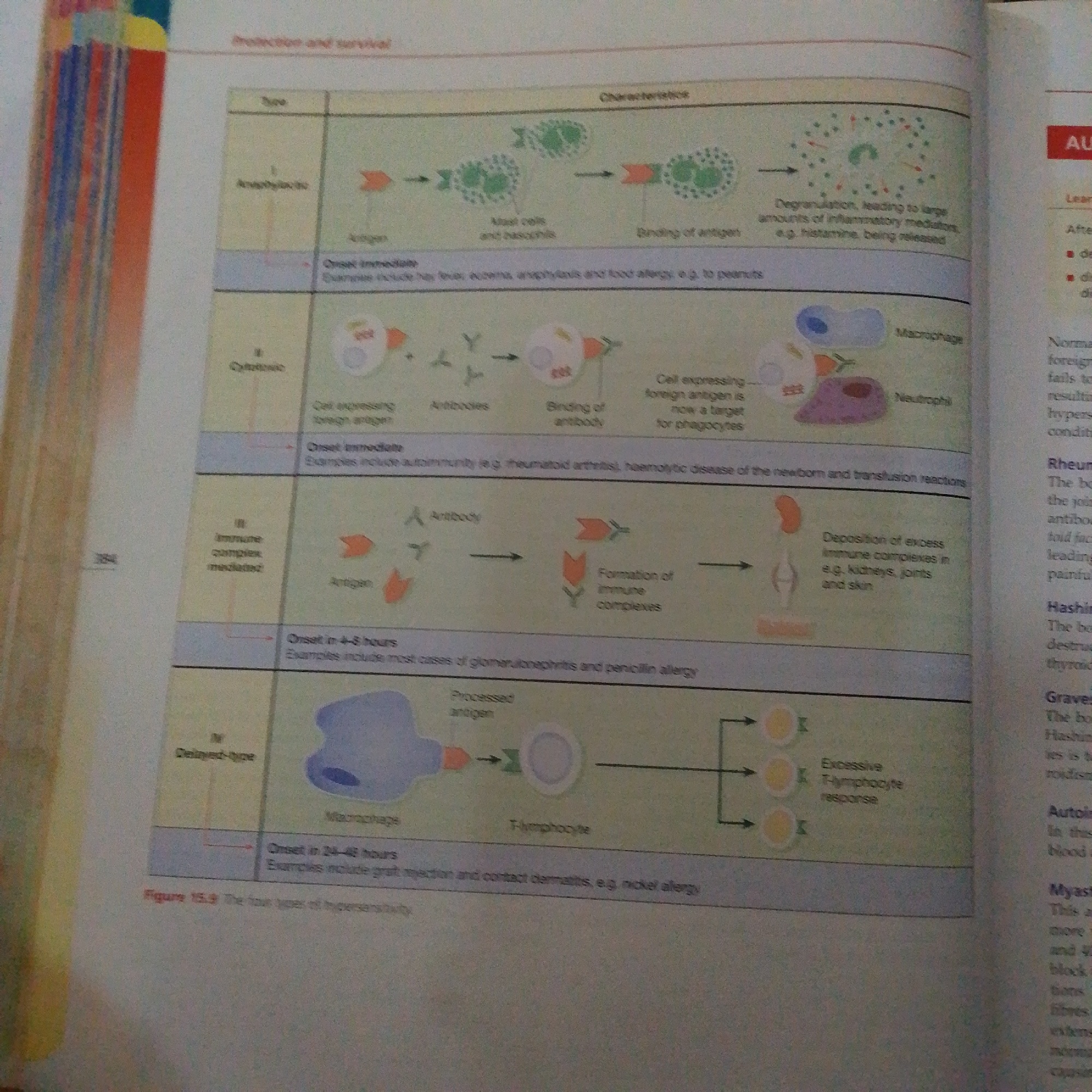 The image is a diagram illustrating the four types of hypersensitivity reactions. It shows a table with columns for "Type," "Characteristics," and then various diagrams depicting the immune response for each type. The types of hypersensitivity are labeled I, II, III, and IV, corresponding to Anaphylactic, Cytotoxic, Immune complex-mediated, and Delayed-type respectively. Each section details the onset time and provides examples of conditions associated with that type of hypersensitivity.
The image does not contain any information related to the city of Jalingo, Nigeria, or any real-world scene. It is purely an informational illustration of a biological concept.